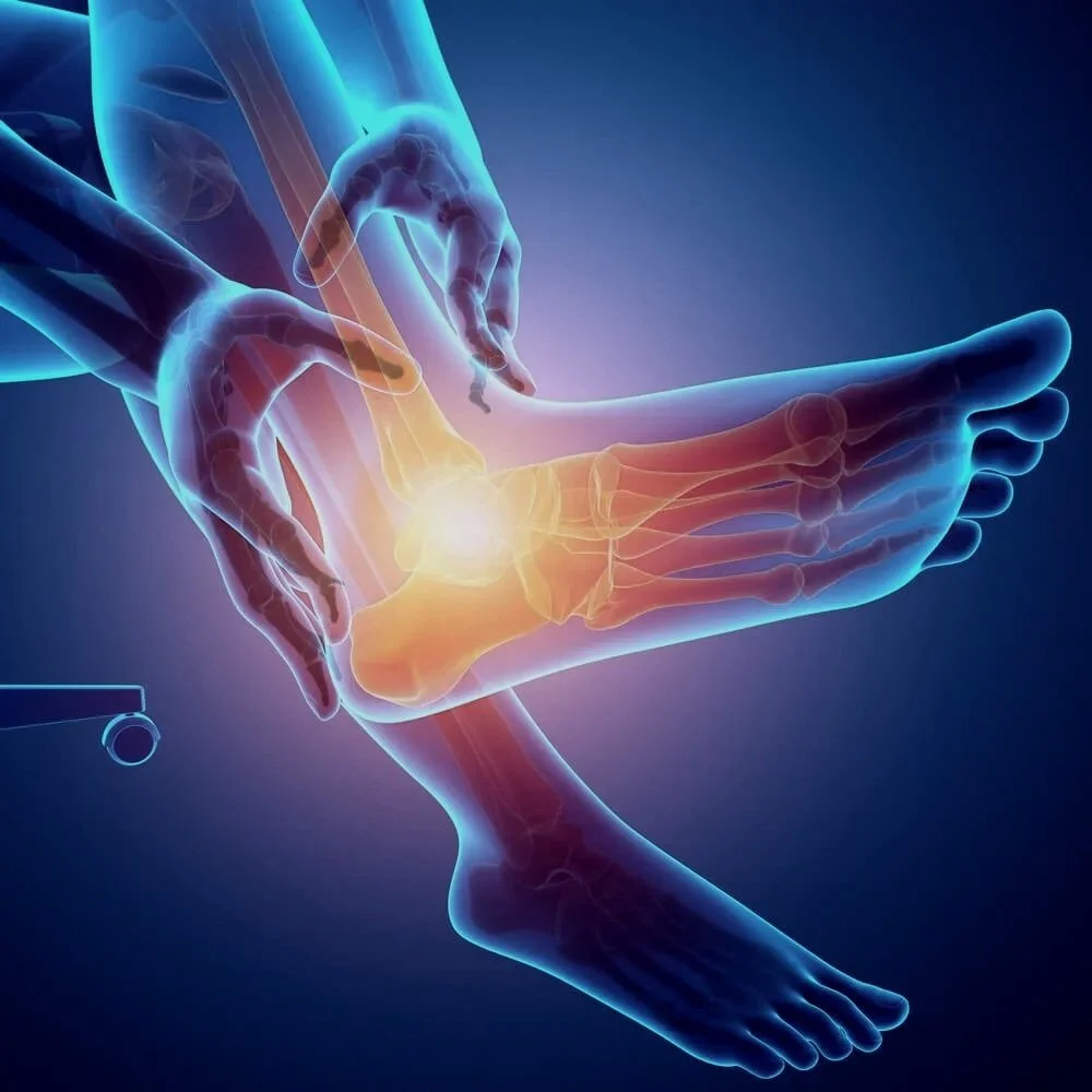 bunion correction surgery - Top Podiatrist serving Rosedale,Woodmere, Inwood, Lawrence, Cedarhurst & Hewlett