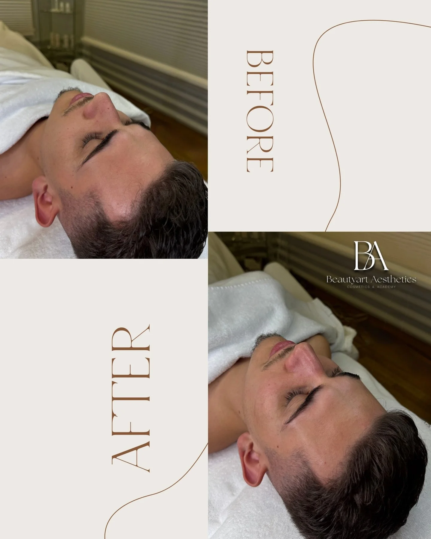 ❄️ Winter Skin Ritual ❄️
K&auml;lte, Wind, trockene Heizungsluft &ndash; unser Winter kann unsere Haut ordentlich fordern. 

Mit unserer Winterpflege-Behandlung regenerierst du deine Haut, st&auml;rkst die Hautbarriere und versorgst sie intensiv mit 