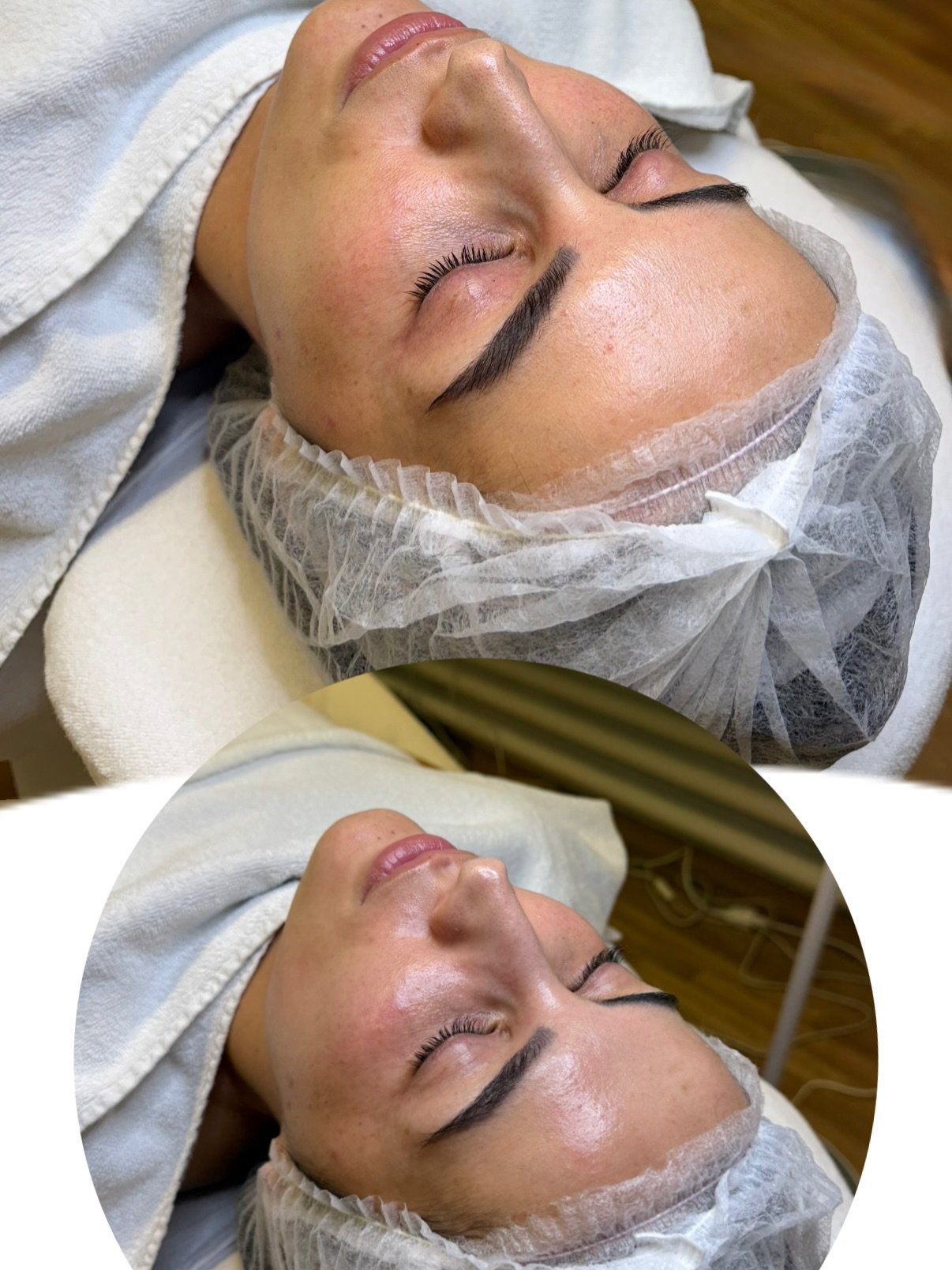 Before Vs After
#fypシ #beforeandafter #skincare #glow #facial #skin #hydrafacial #radiofrequenz #ultraschall #hydration #skingoals #viralvideos