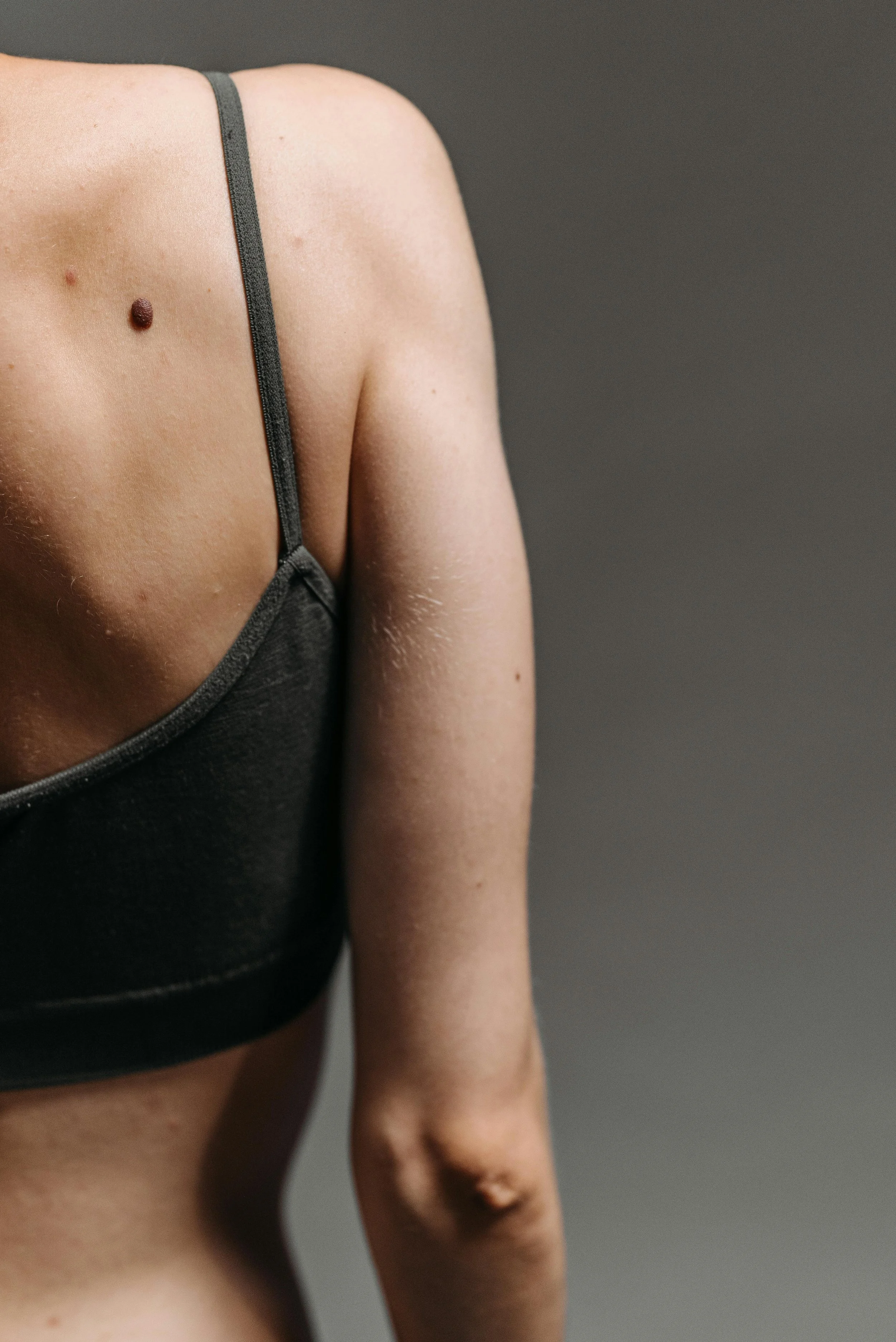 Why Winter Is a Strategic Time to Treat Scars — And Why Timing Matters