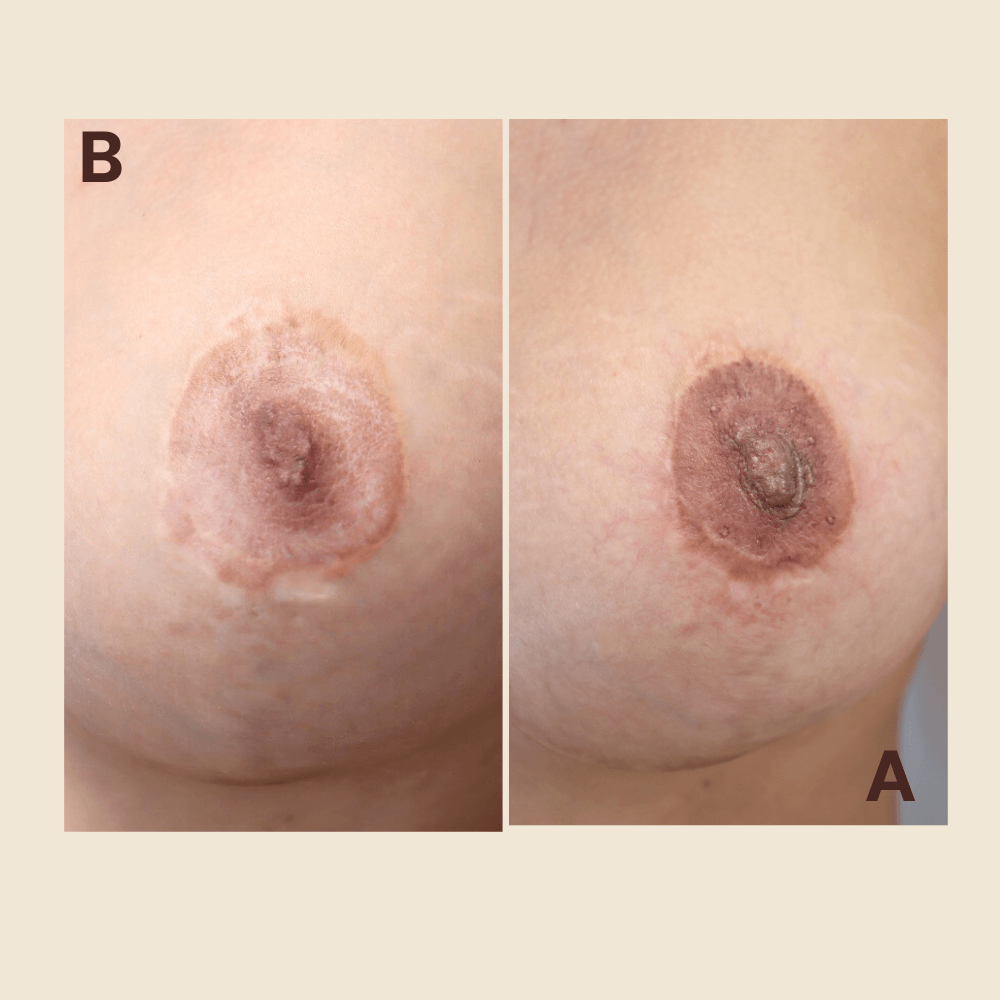 3d Areola tattoo shape