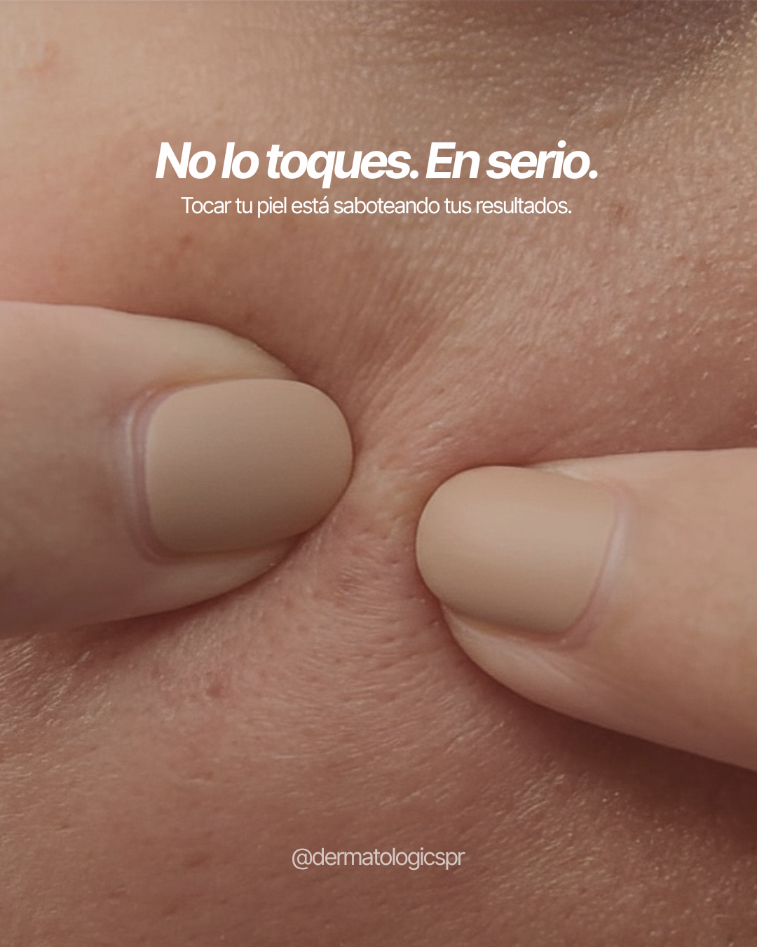 Nolotoques.png