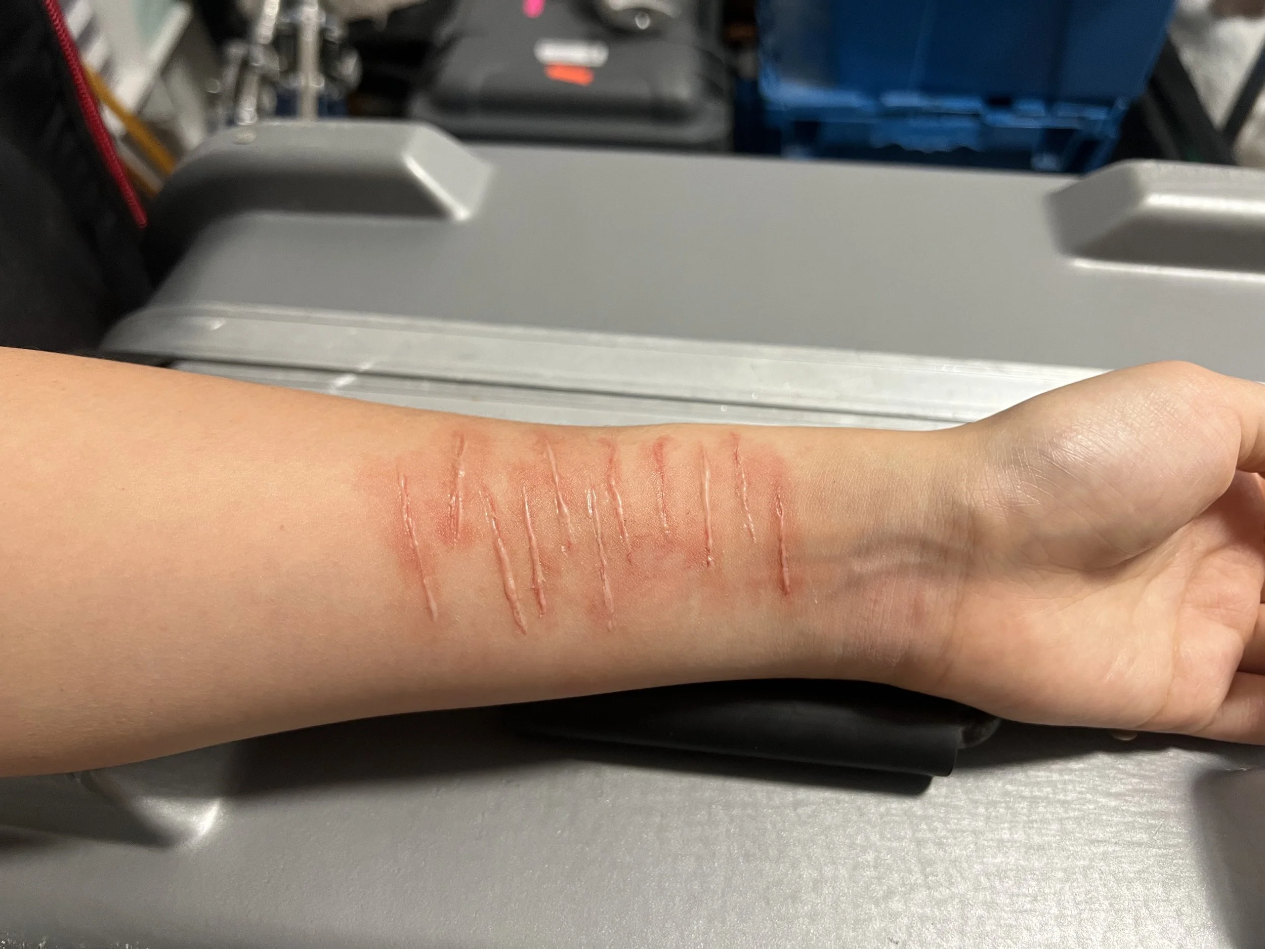 Silicone, Fresh-er Scar
"Summer, the Suicidal Lizard," Dir. Jasmine Yumei Zhang