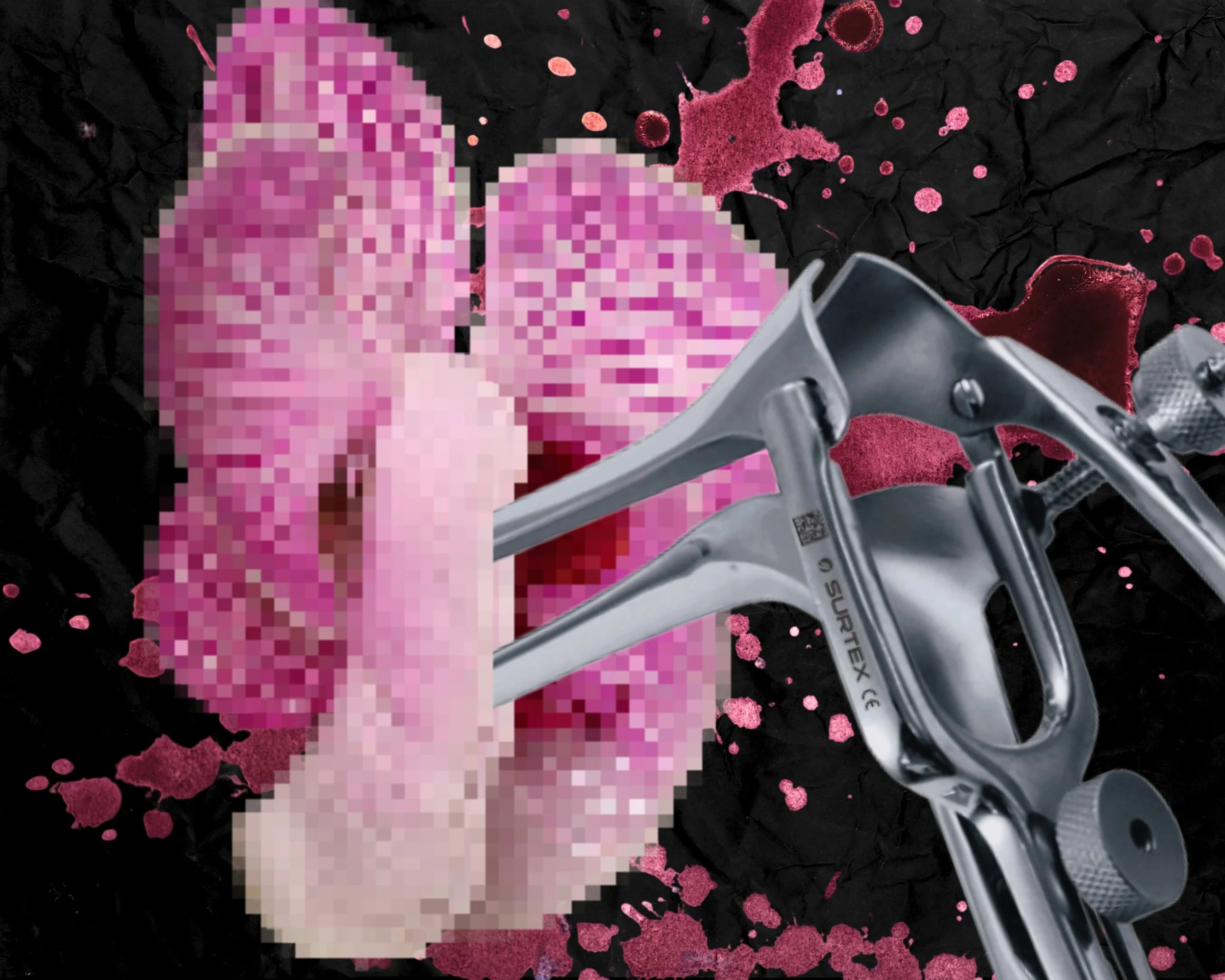 It Begins With the Worms