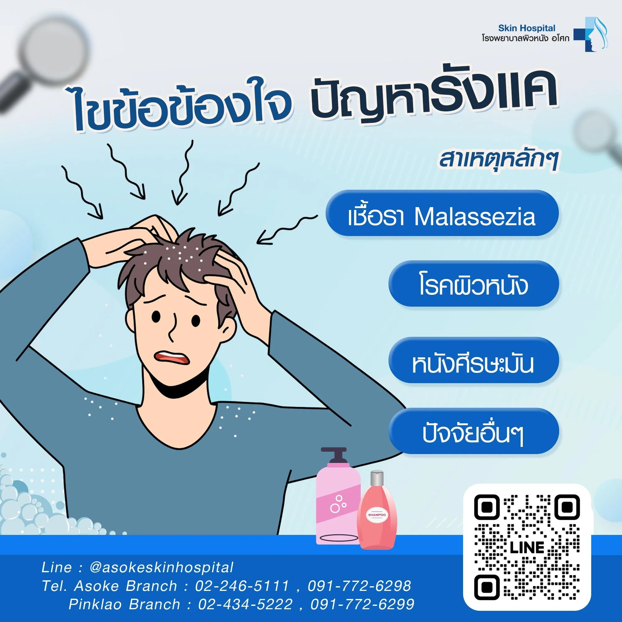 รังแค เป็นปัญหาที่หลายคนเคยเจอ อาจทำให้รู้สึกคันและขาดความมั่นใจ สาเหตุของรังแคนั้นซับซ้อนและมีหลายปัจจัยร่วมกันค่ะ โดยหลักๆ แล้วเกิดจากการที่เซลล์ผิวหนังบนหนังศีรษะหลุดลอกออกมาเร็วกว่าปกติ จนเห็นเป็นขุยสีขาว 😶&zwj;🌫️

สาเหตุหลักๆ ของรังแคมีดังนี้?