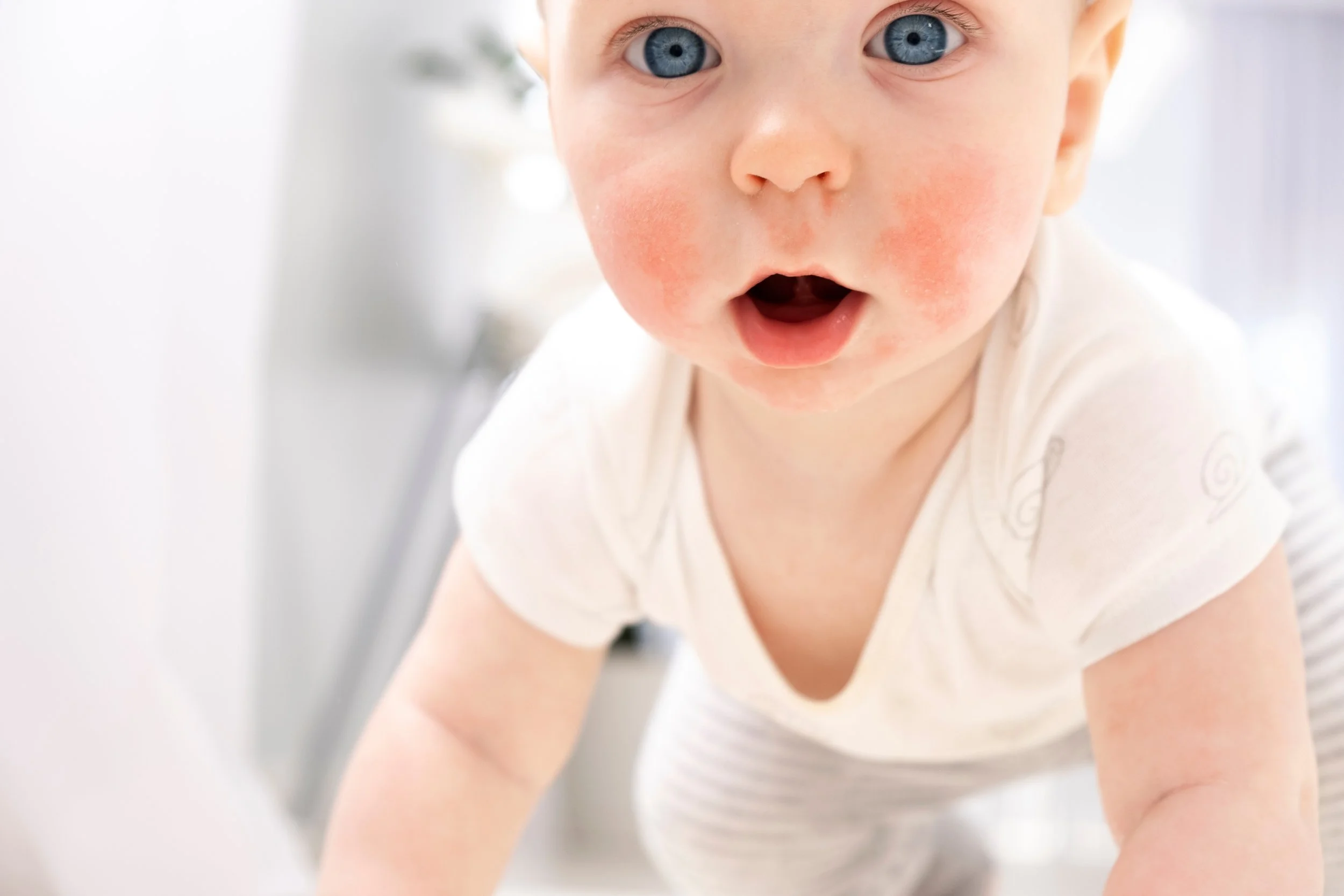 โรคติดเชื้อบริเวณผิวหนังในเด็ก