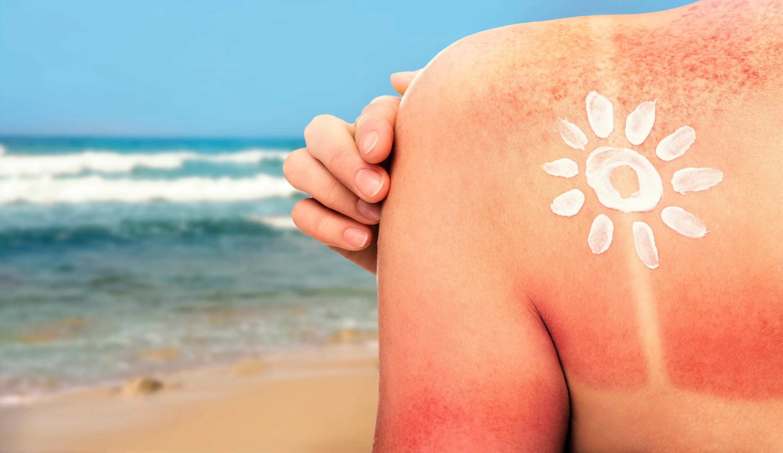 Skin Cancer(มะเร็งผิวหนัง)
