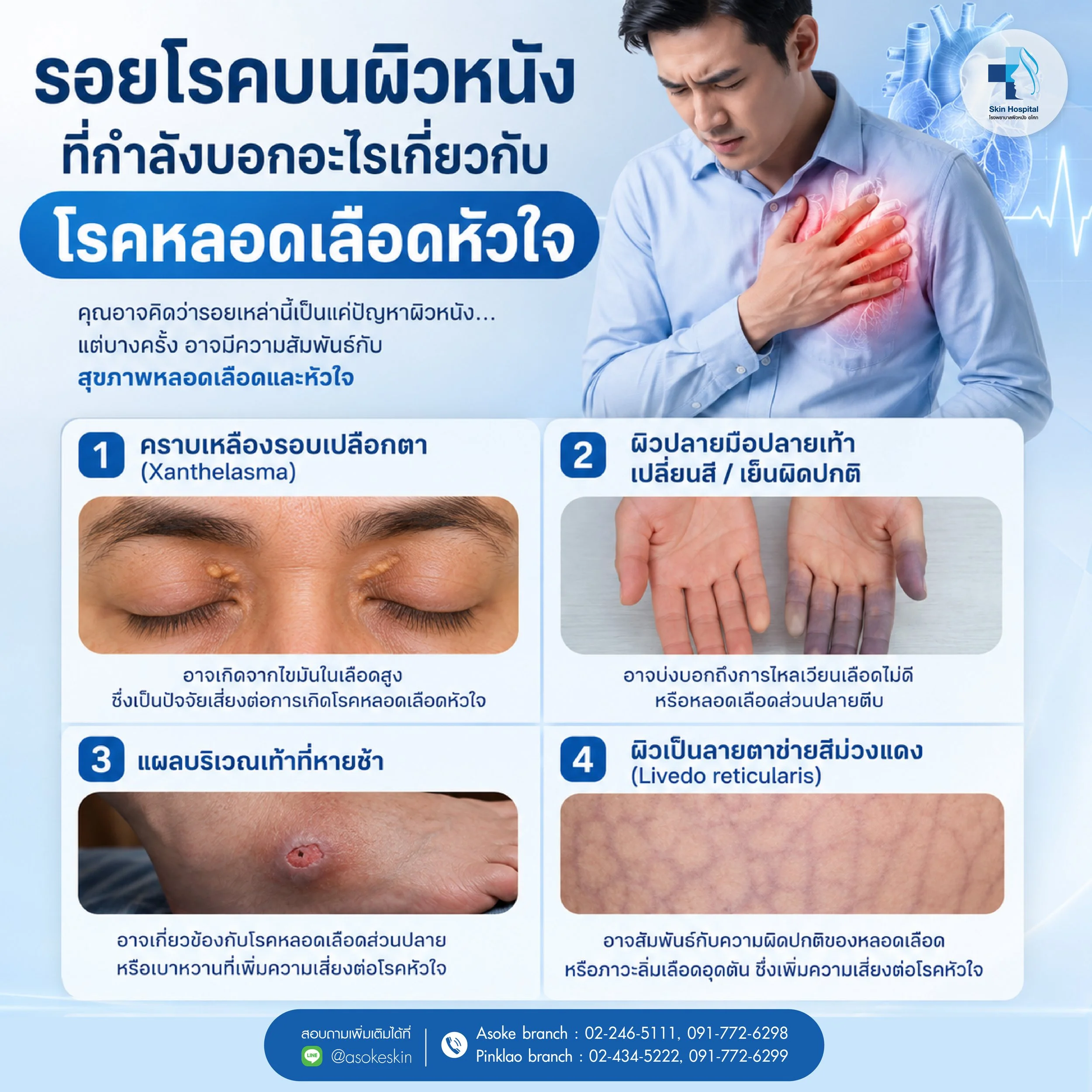 รอยโรคบนผิวหนัง ที่กำลังบอกอะไรเกี่ยวกับโรคหลอดเลือดหัวใจ