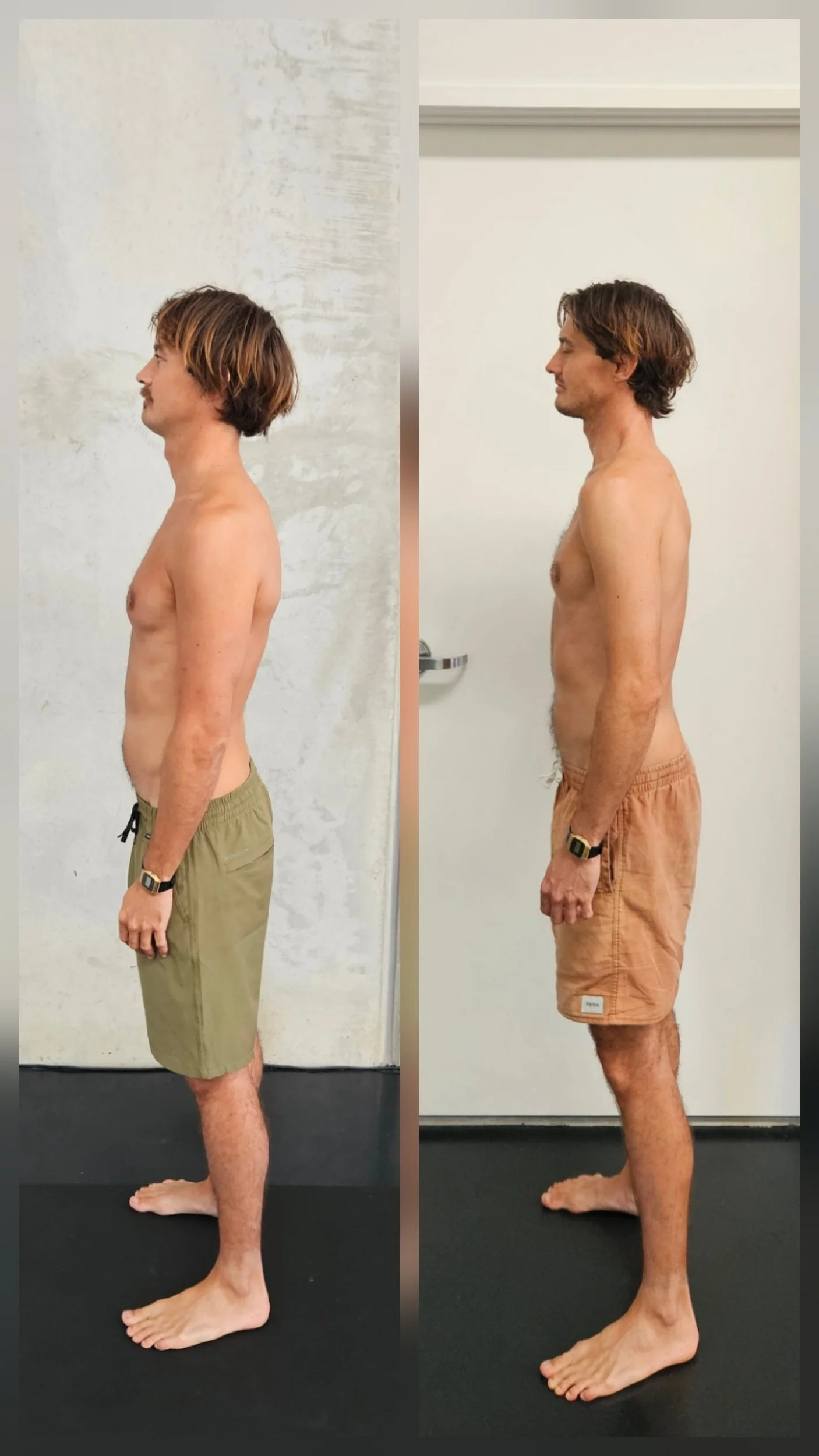 Can a personal Trainer Fix your Posture? (Most can’t)