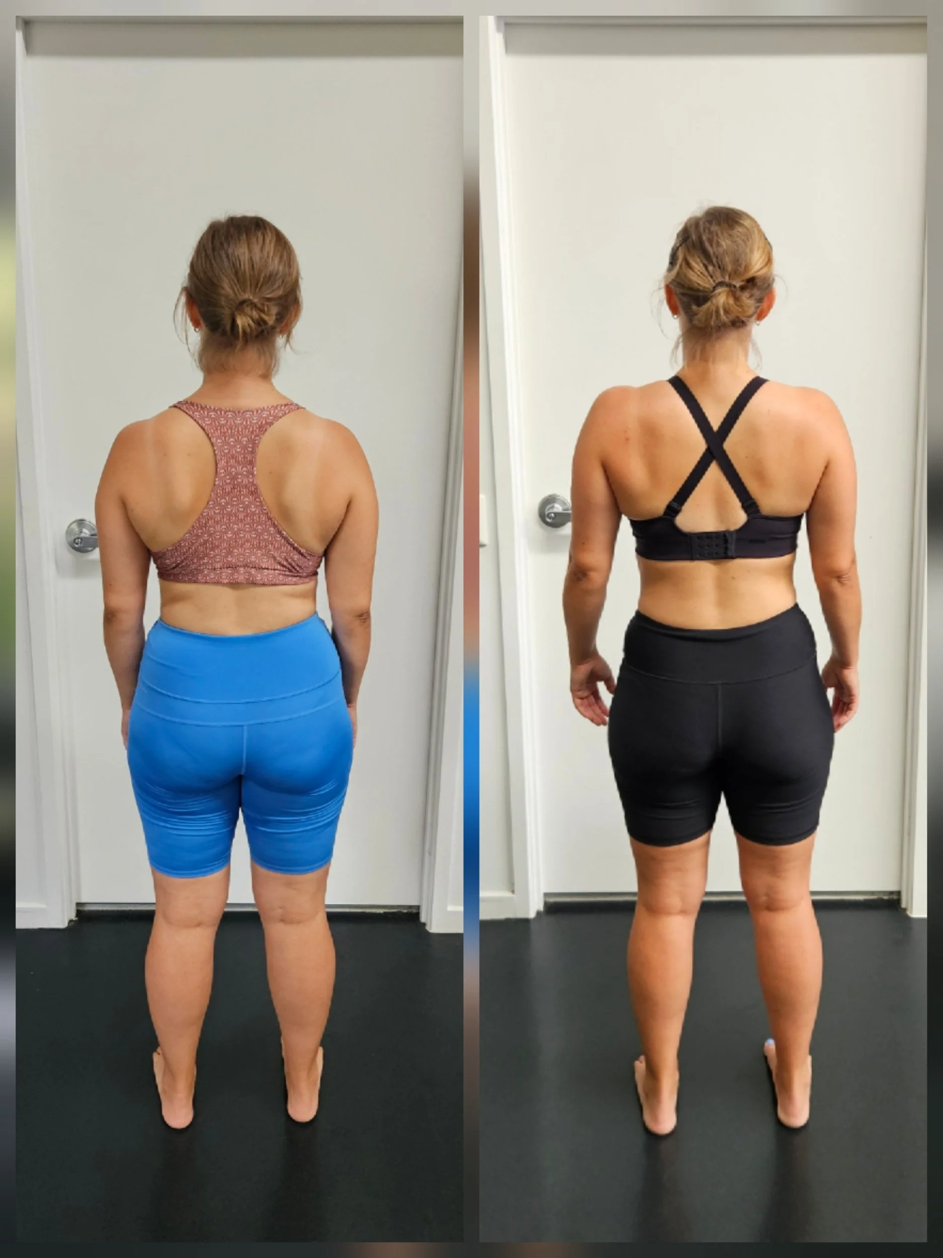 Functional Patterns vs Chiro, Physio, Osteo &amp; Massage: Symptoms VS Systems