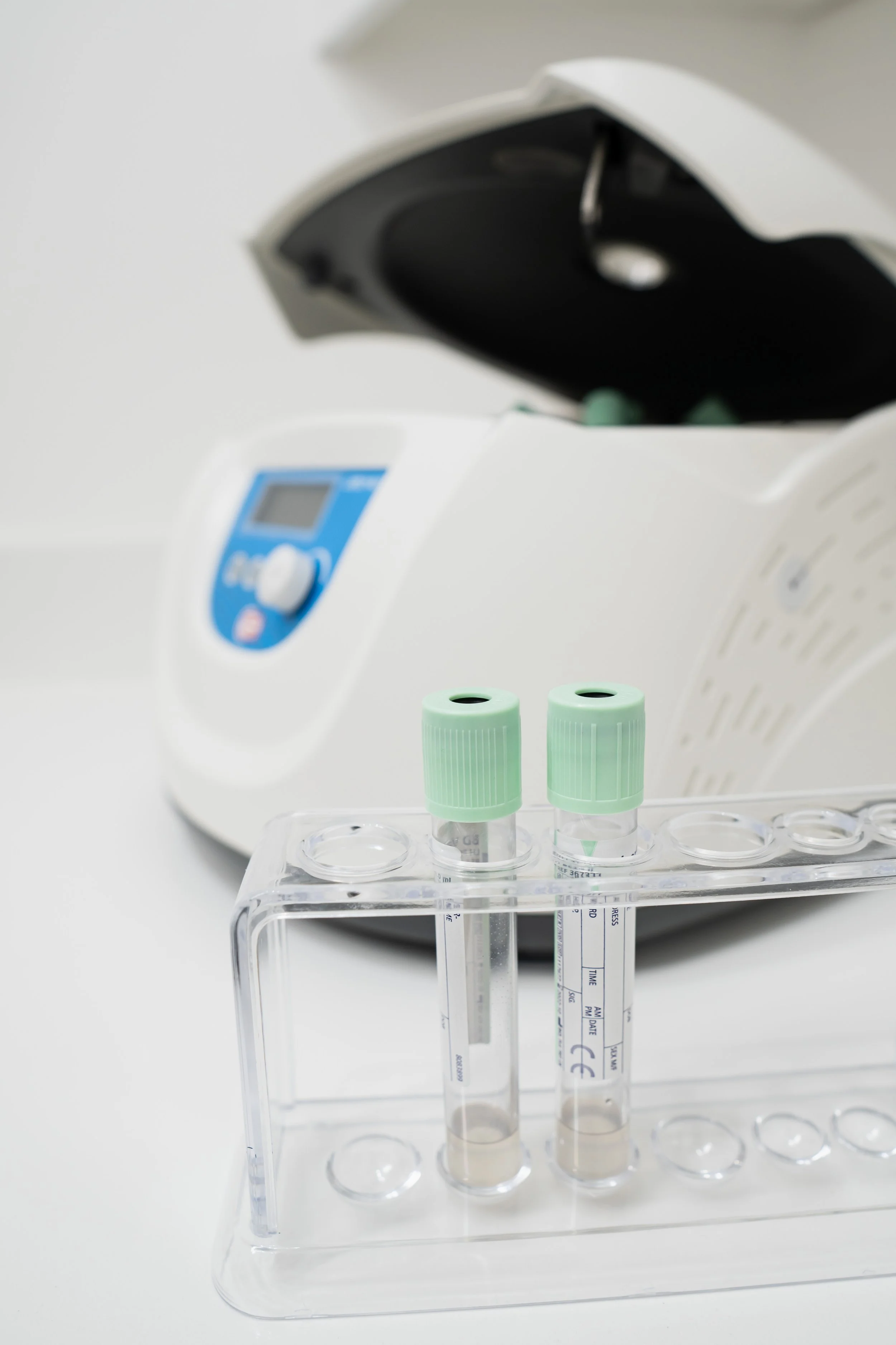 PRP Hair Restoration in London Bridge