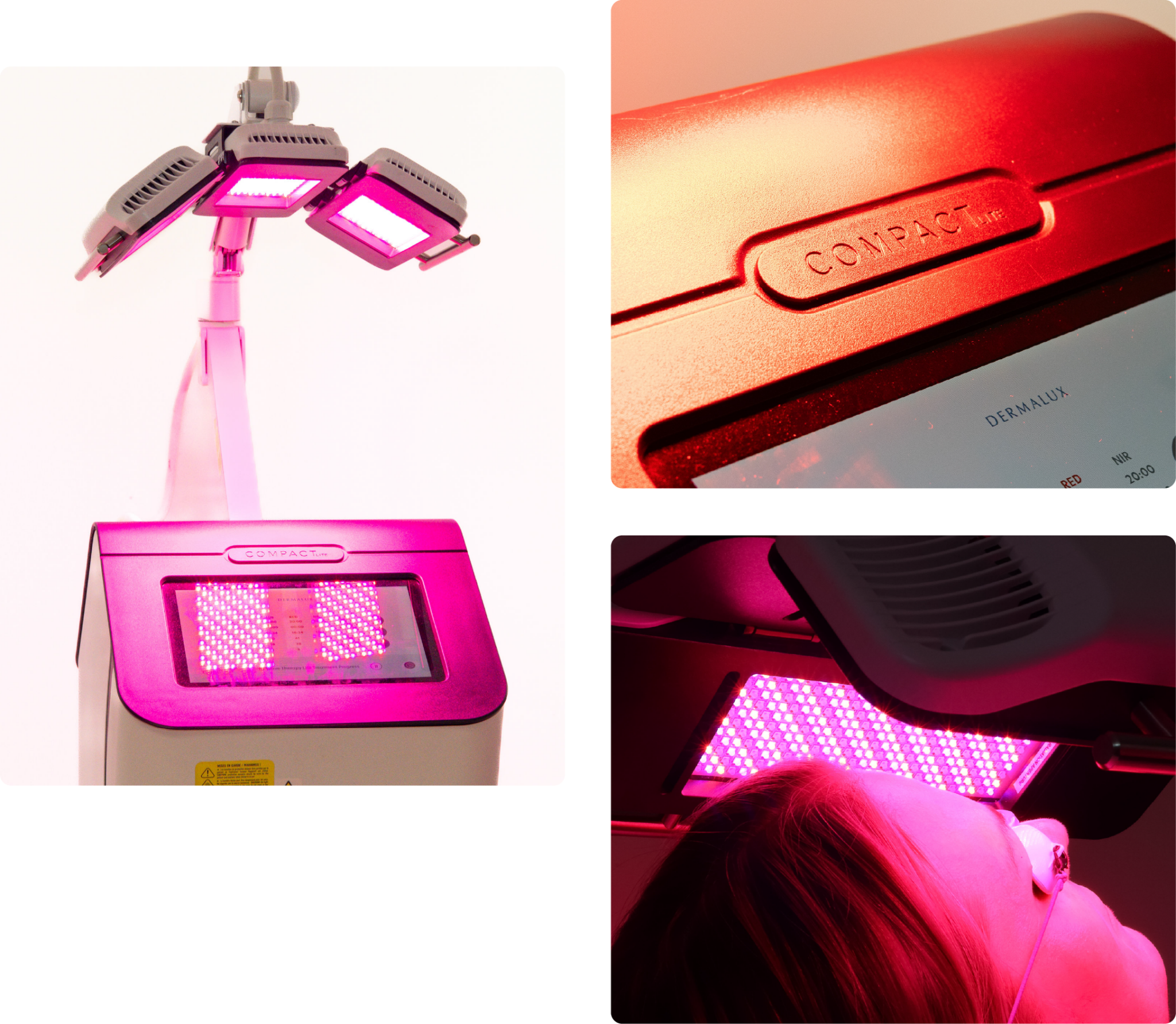 Dermalux LED light therapy in london