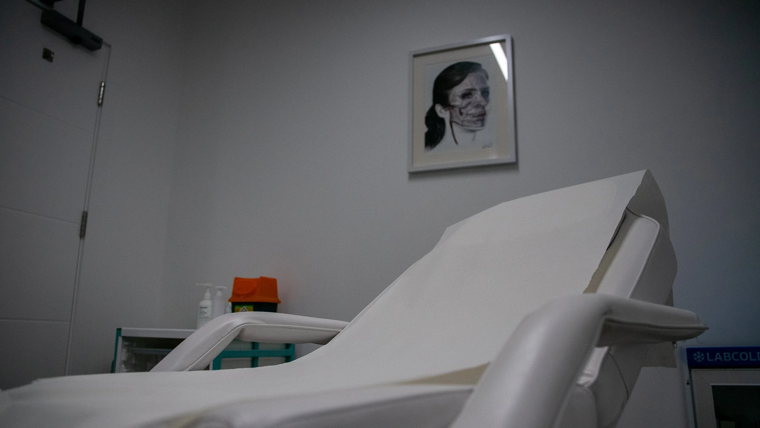 Dermal filler treatments in London Bridge for lips, cheeks, tear trough, chin, jawline, nasolabial folds and marionette lines. Personalised facial assessment and natural-looking results at Derma Consult Skin Specialist.
