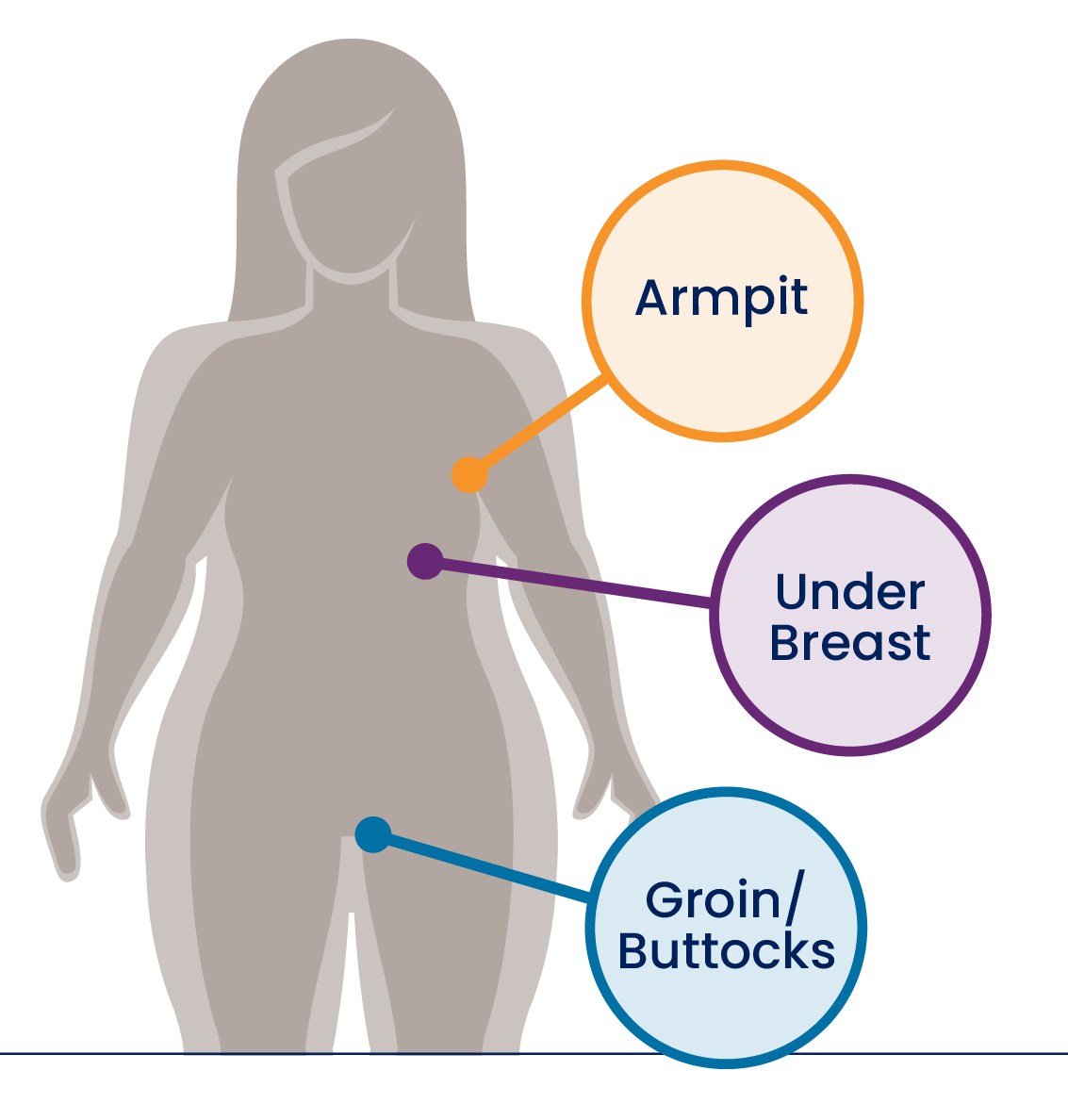 Diagram of female body highlighting the armpit, under breast, and groin/buttocks areas with labels.