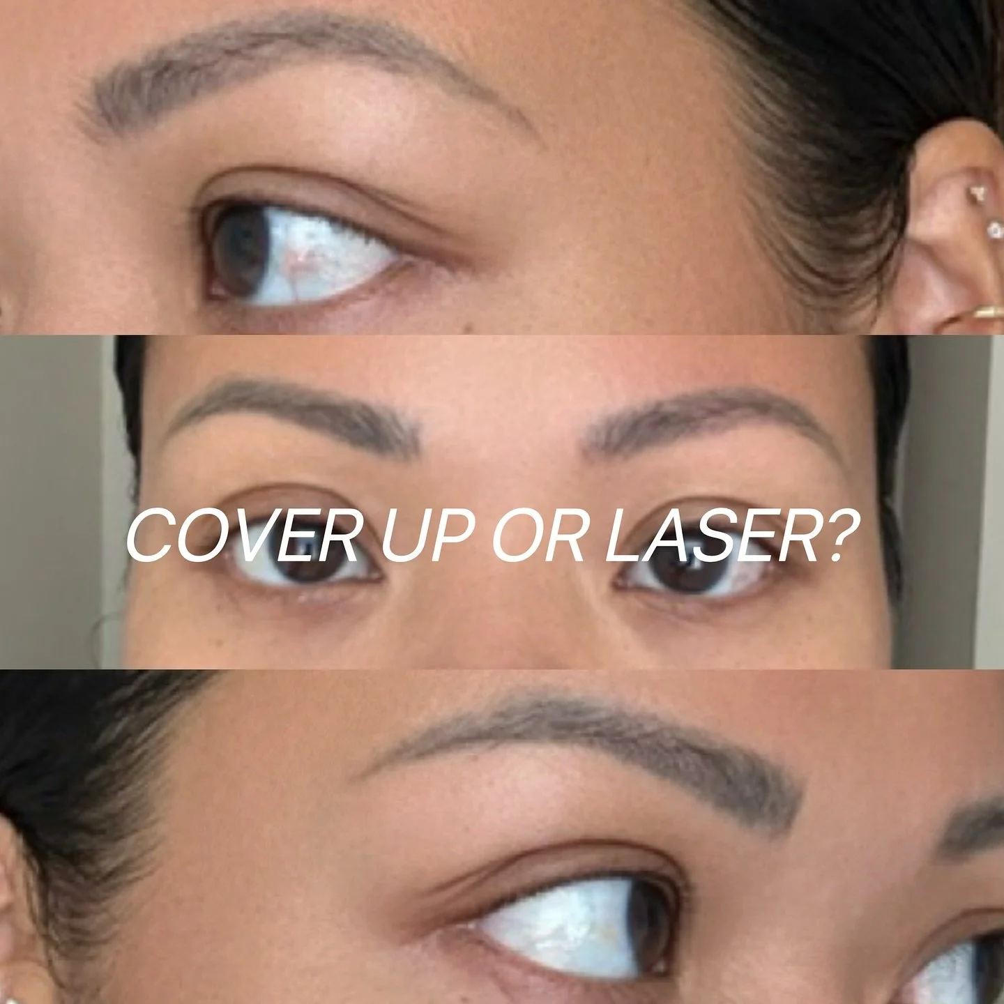 To cover up or to laser? 🧐

Her brows had faded over time, but as an artist, I could see her skin was still holding onto a lot of pigment. She wanted something softer and more natural, but first we had to clear out some of the old color.

Think of i