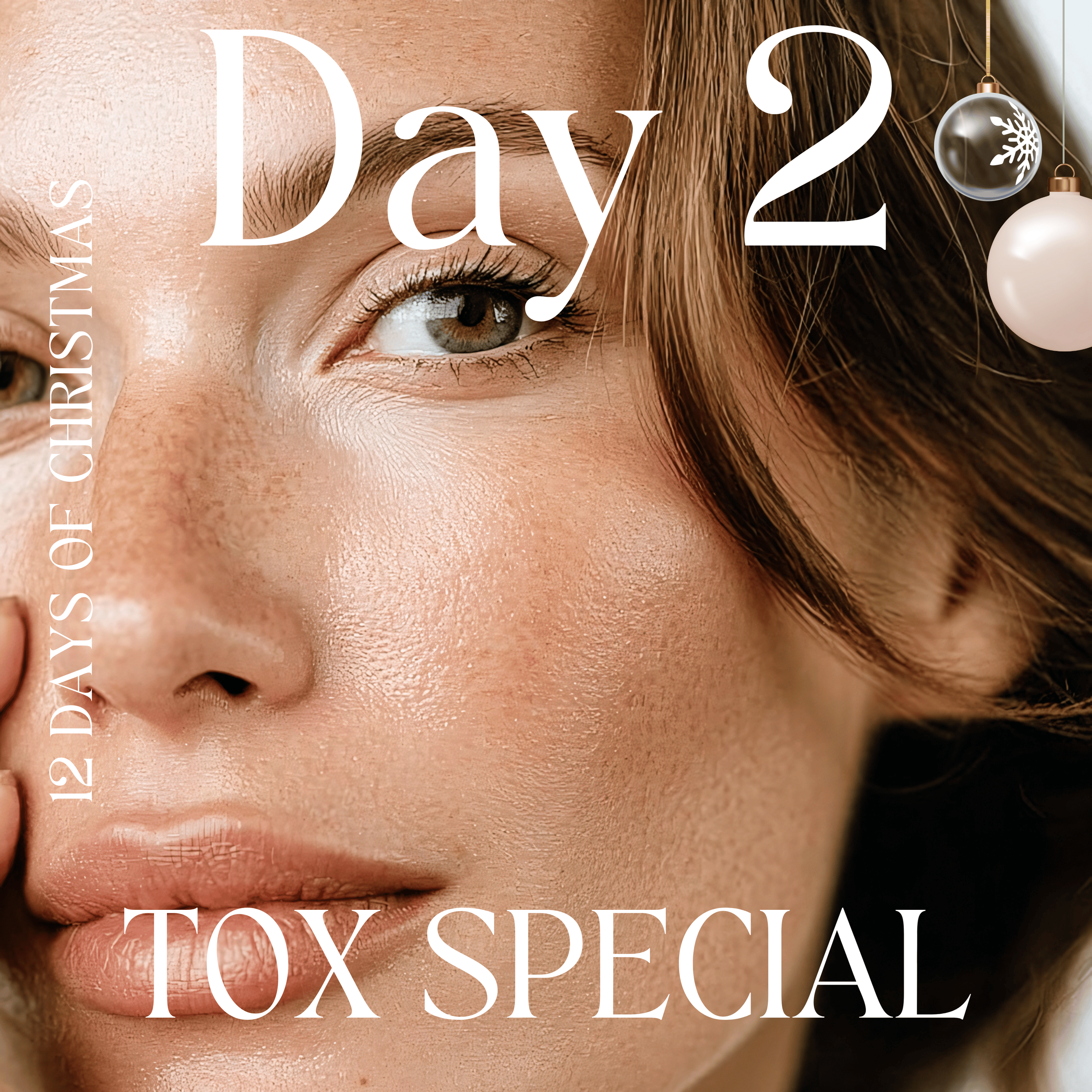 12 days of Christmas | Day 2: TOX Special