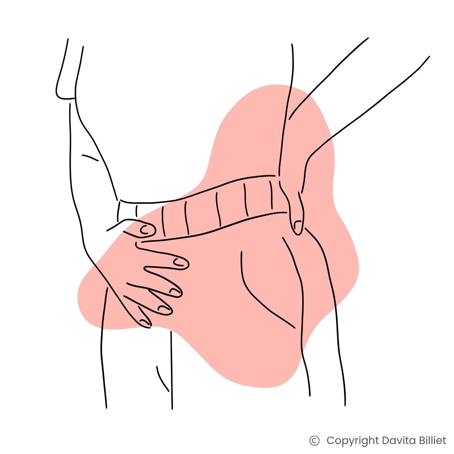 Eine Person mit Unterleibs- und Rückenschmerzen infolge von Verwachsungen, die nach einer Bauchspiegelung wegen Endometriose entstanden sind.