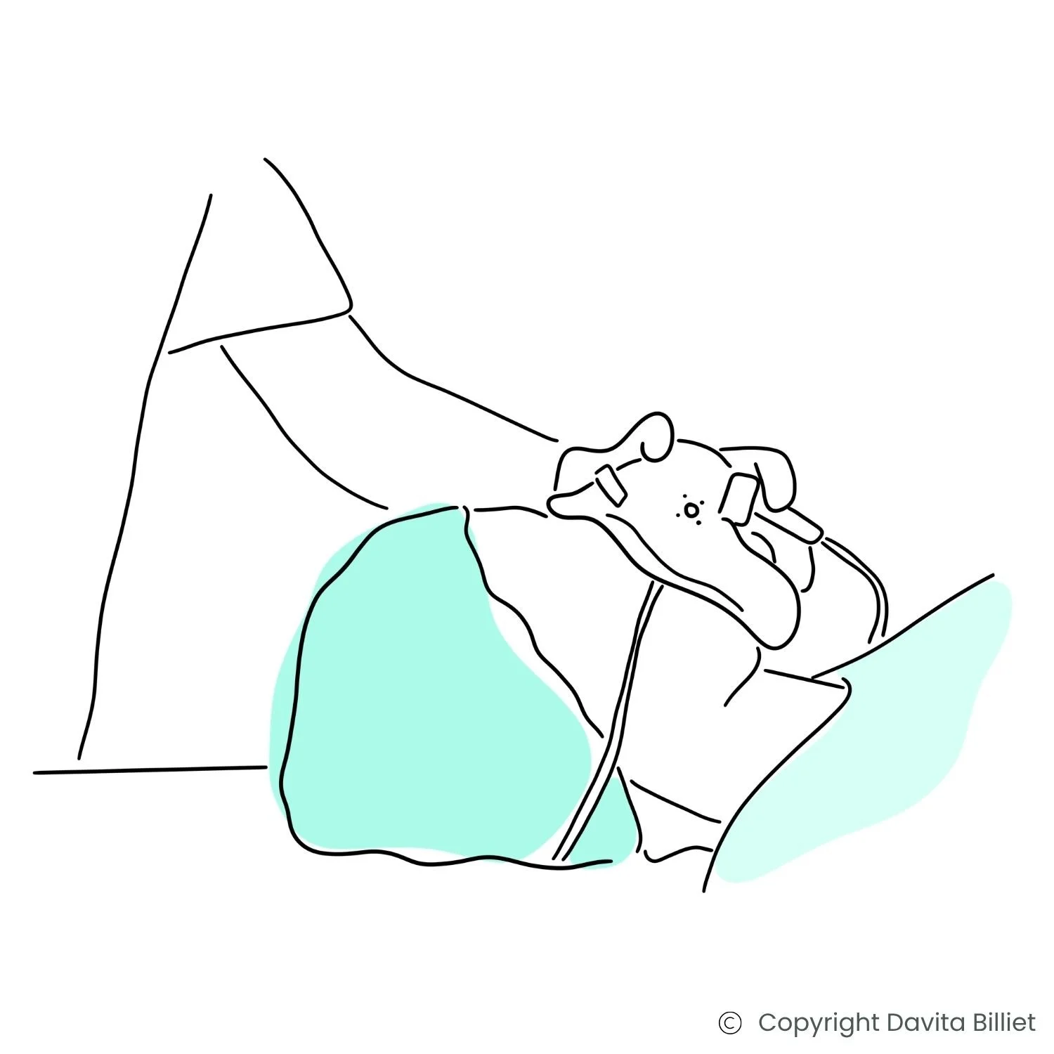 Medizinische Illustration einer Vollnarkose-Einleitung vor einer Laparoskopie bei Endometriose.