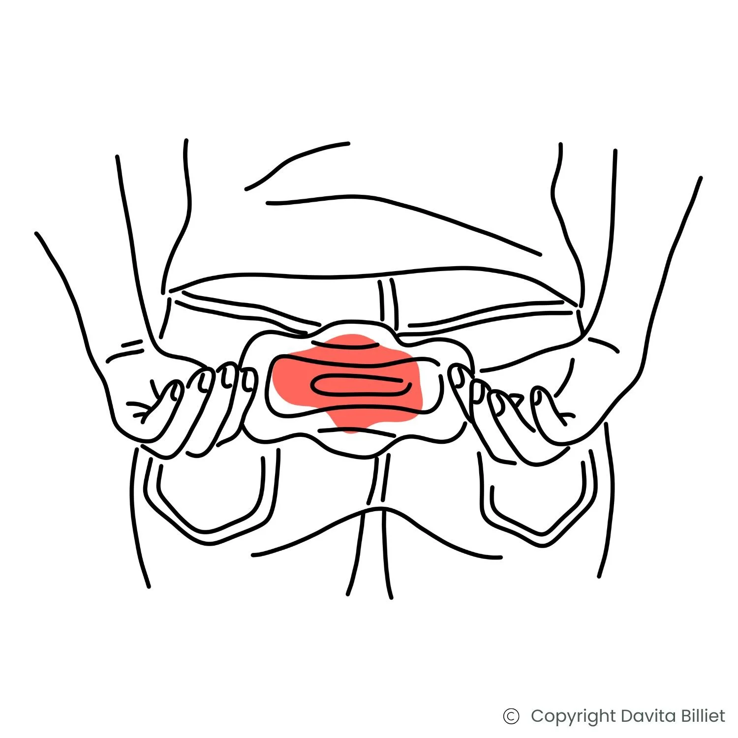 Eine Frau, die eine blutige Menstruationsbinde hinter ihrem Rücken versteckt, als Symbol für starke Regelblutungen.