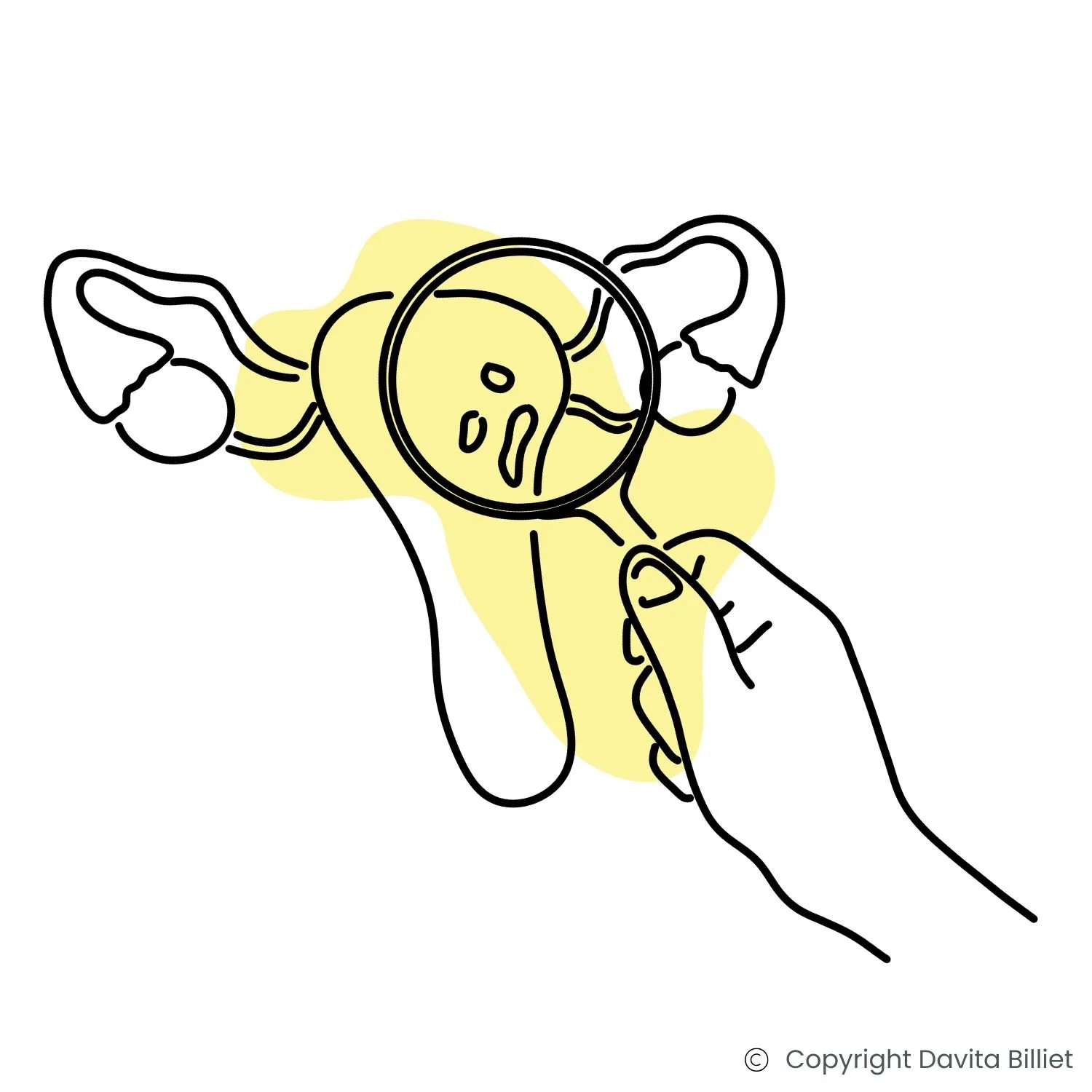 Endometriose, die bei einer Untersuchung des Unterbauchs festgestellt wird.