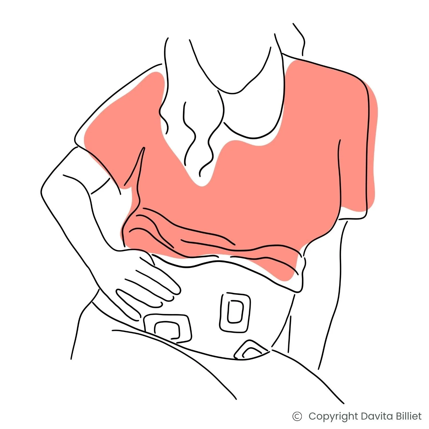 Illustration einer Frau nach einer Laparoskopie bei Endometriose mit empfindlichem, geschwollenem Bauch und Pflastern an den Schnittstellen.