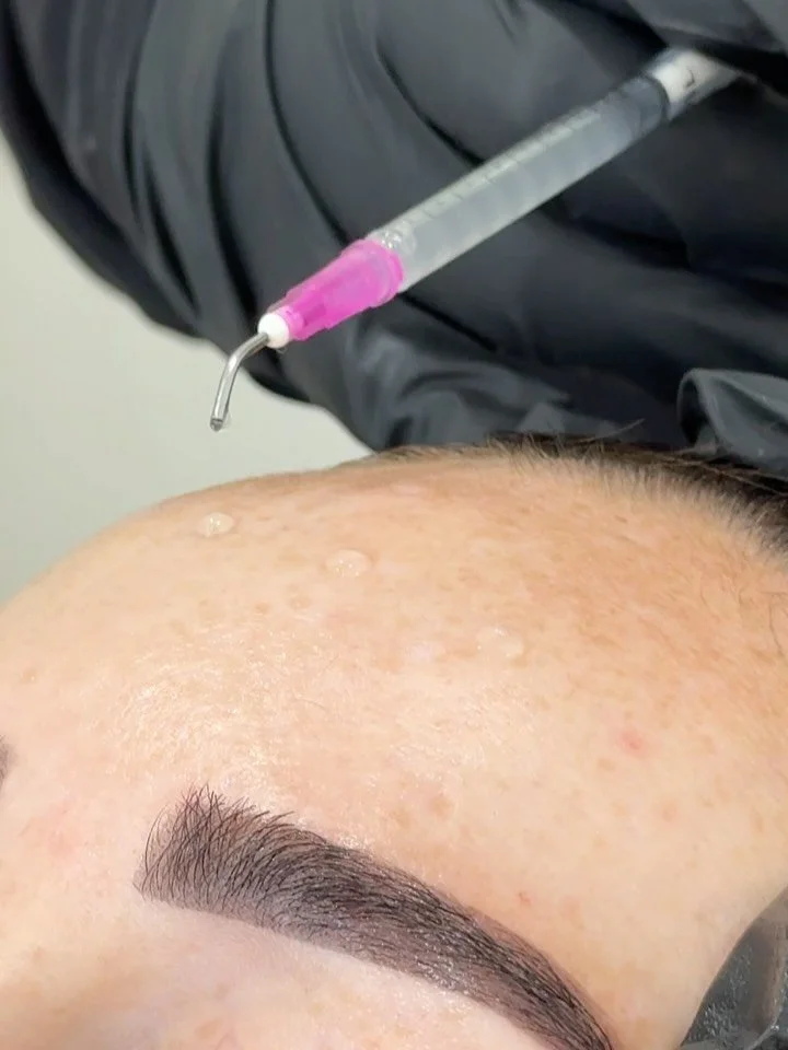 Understanding the PRX Treatment Process
PRX is a professional topical biostimulator treatment performed in-clinic by our registered nurses. It’s designed to support overall skin quality and radiance through a gentle, topical application.
