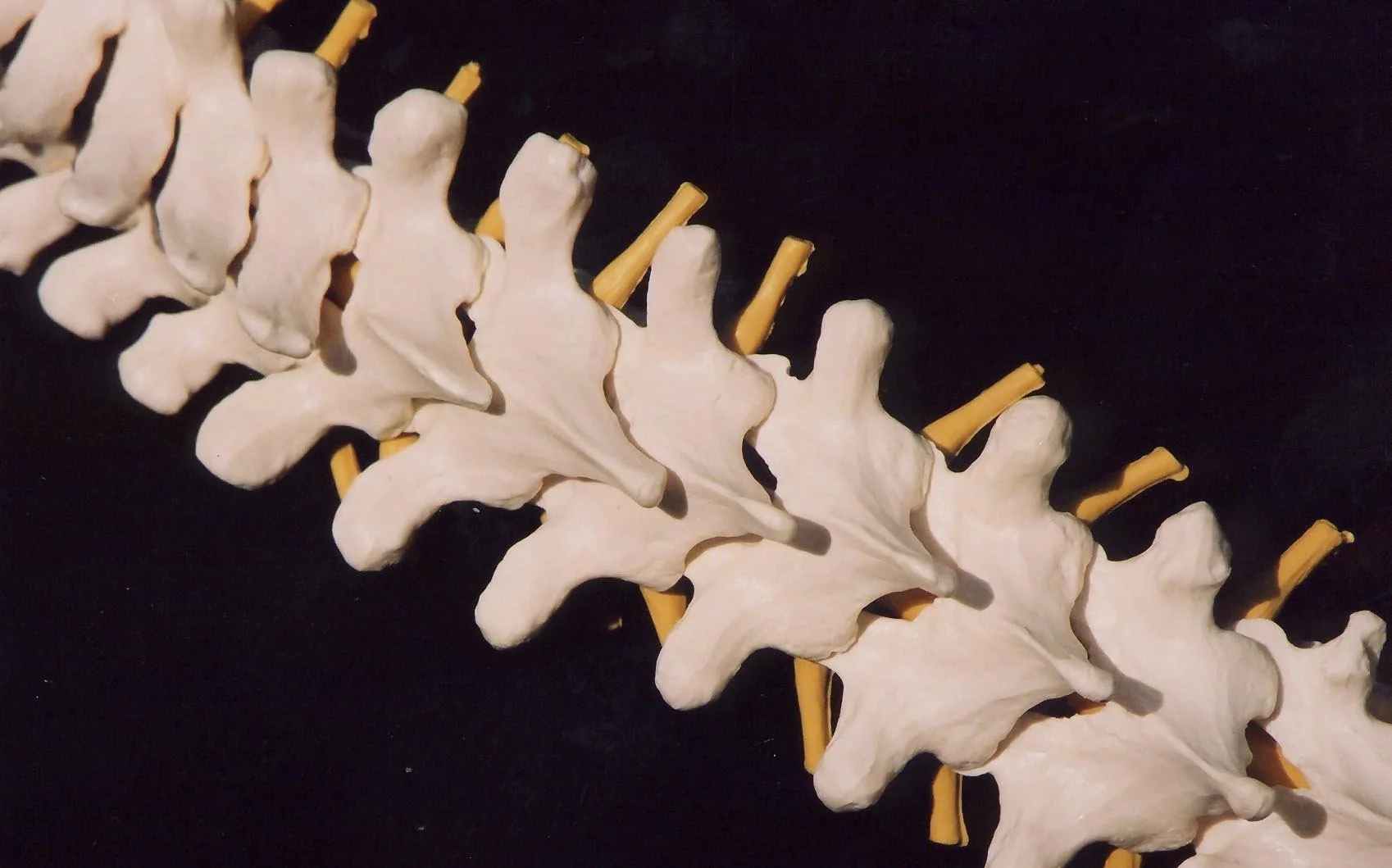 spine2.jpg