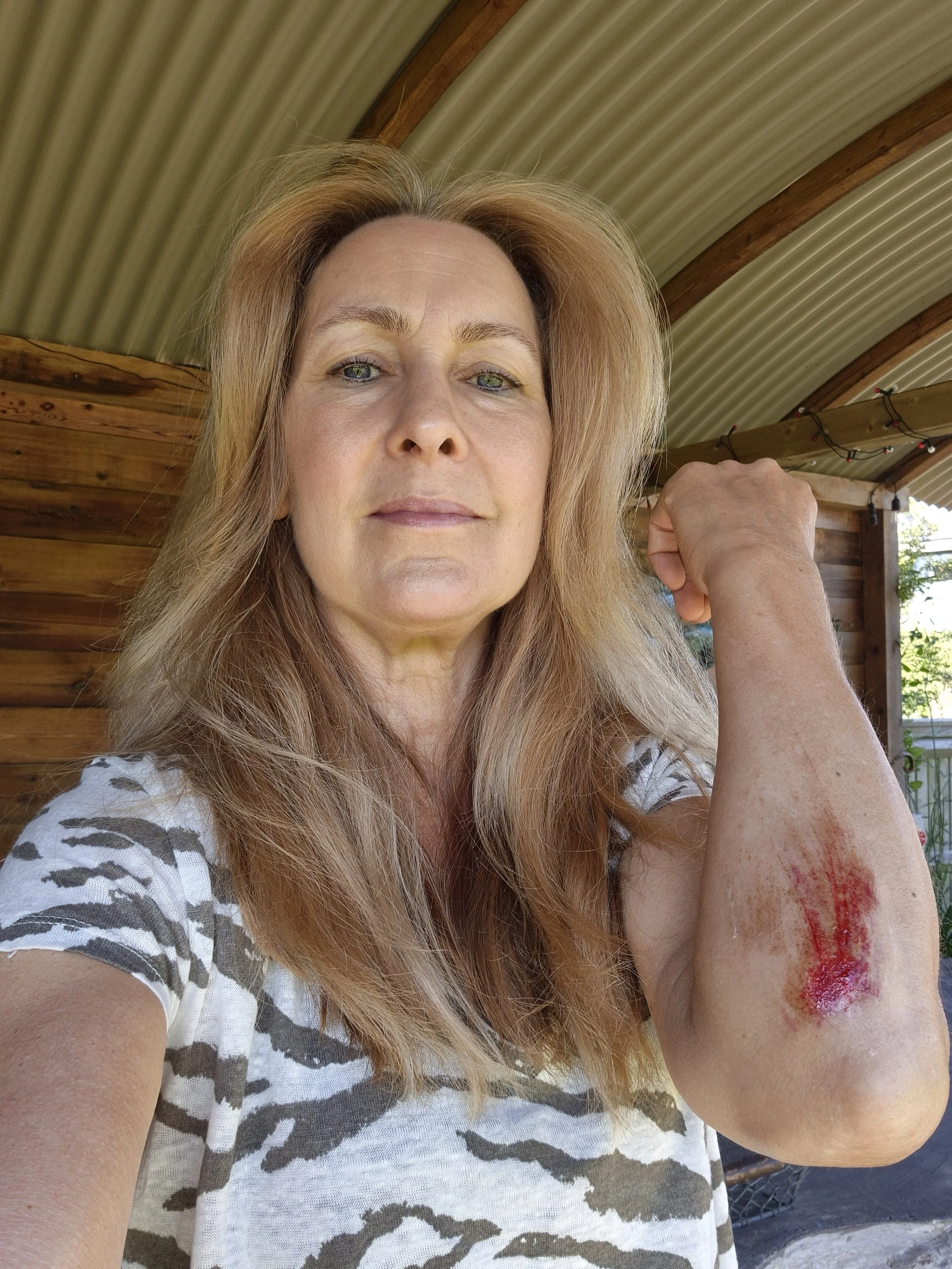 I love my mountain bike, but I don't always stay on it. Here's the result of a slow motion fall over the handlebars - DOH