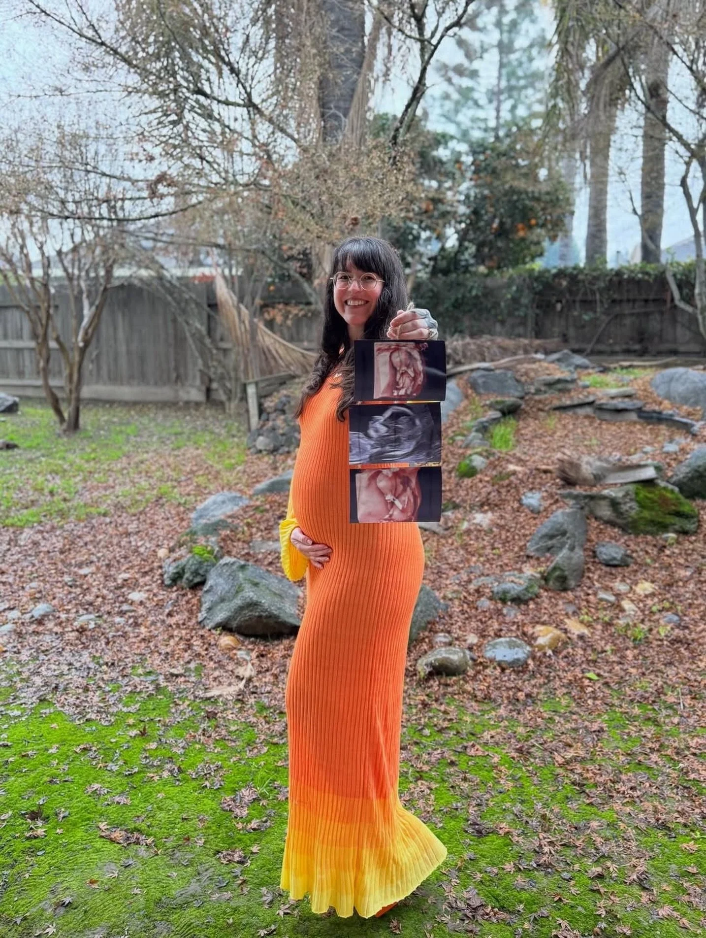 Congratulations to thriver @itsmesamanthalee!! 🤰✨

#babiesafterbreastcancer #tnbcthrivers #lifeaftercancer