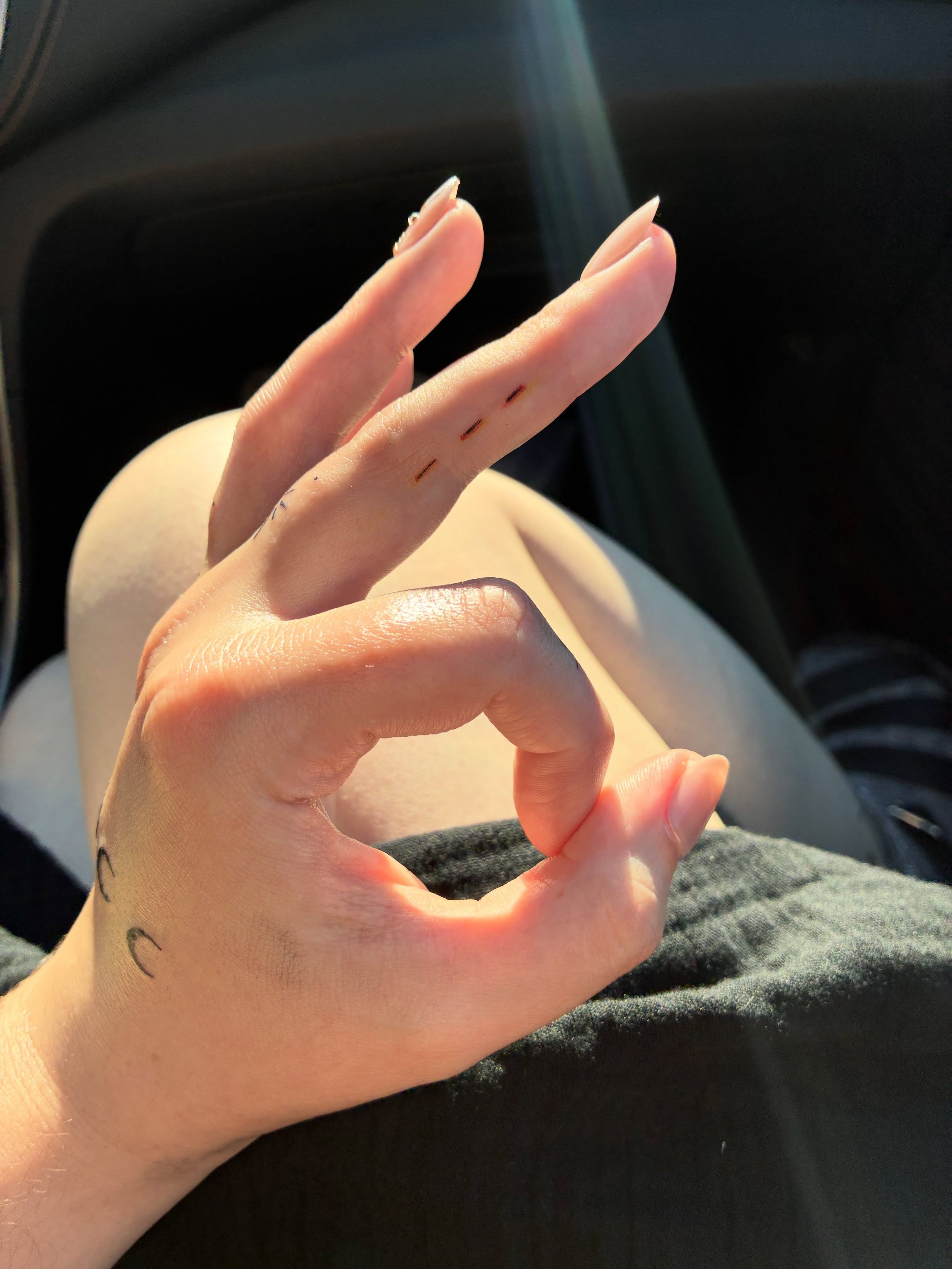 My name is Julia (@ju.partridge) and I was diagnosed at 23 in March 2024. Came pretty close but did not get PCR so I did my whole 15 months of treatment, treatment, and more treatment. 

To celebrate my 2 years NED, I got a few new tattoos including 