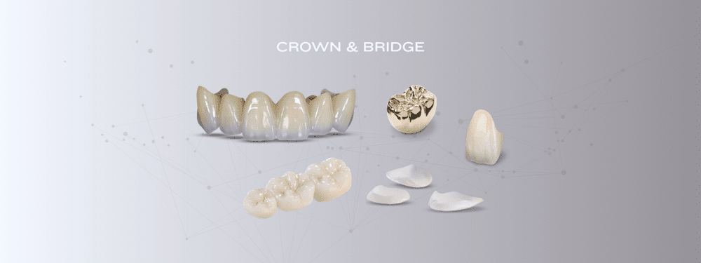 Dentures & Guards - Interstate Dental Lab