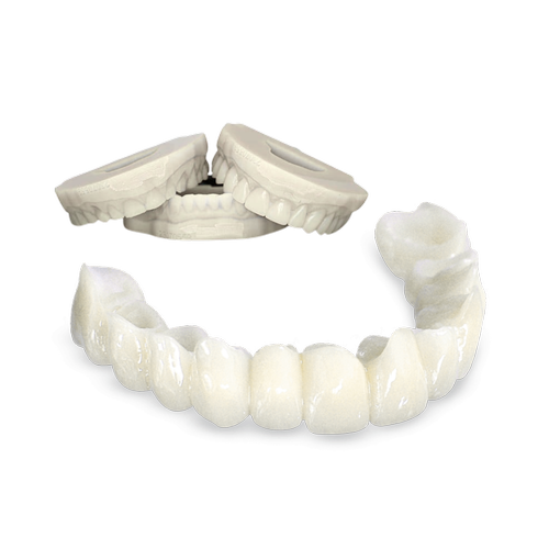 Provisionals & Wax-Ups