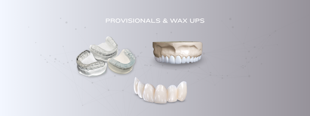 Provisionals & Wax-Ups