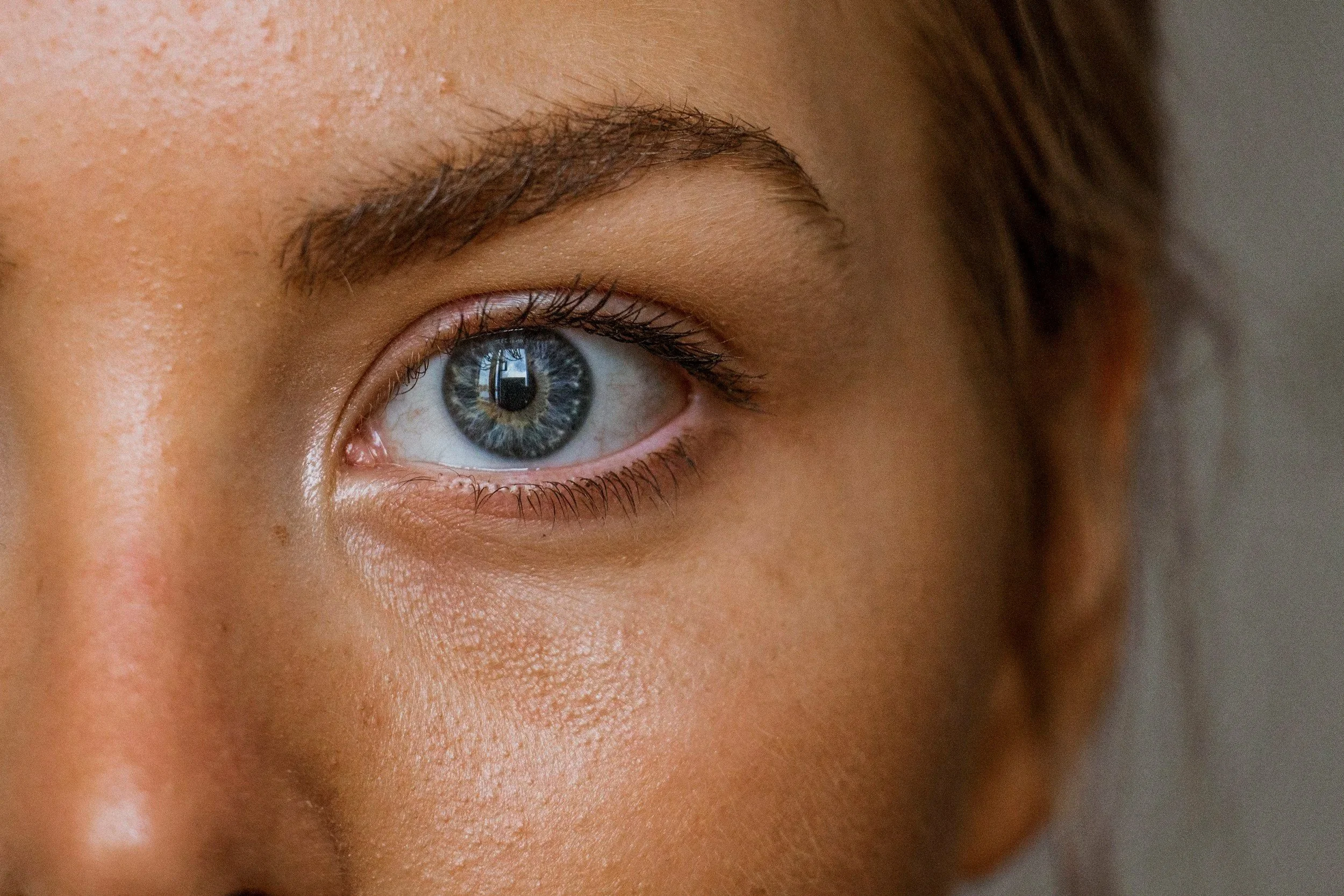 woman's eye during Accelerated Resolution Therapy