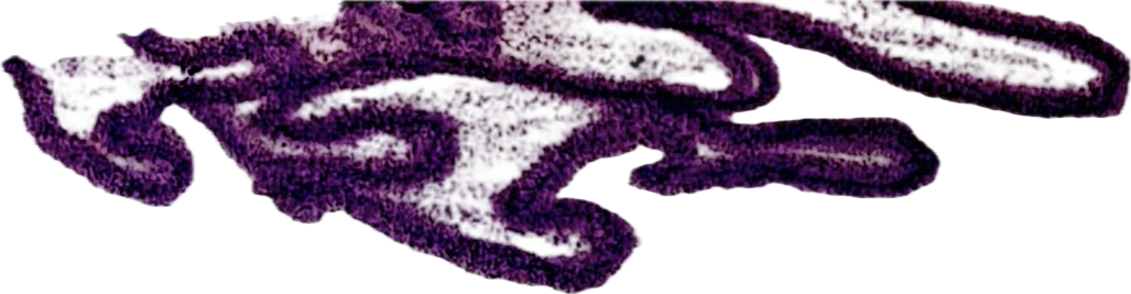 Close-up of purple yarn or thread, possibly part of a knitting or crafting project.