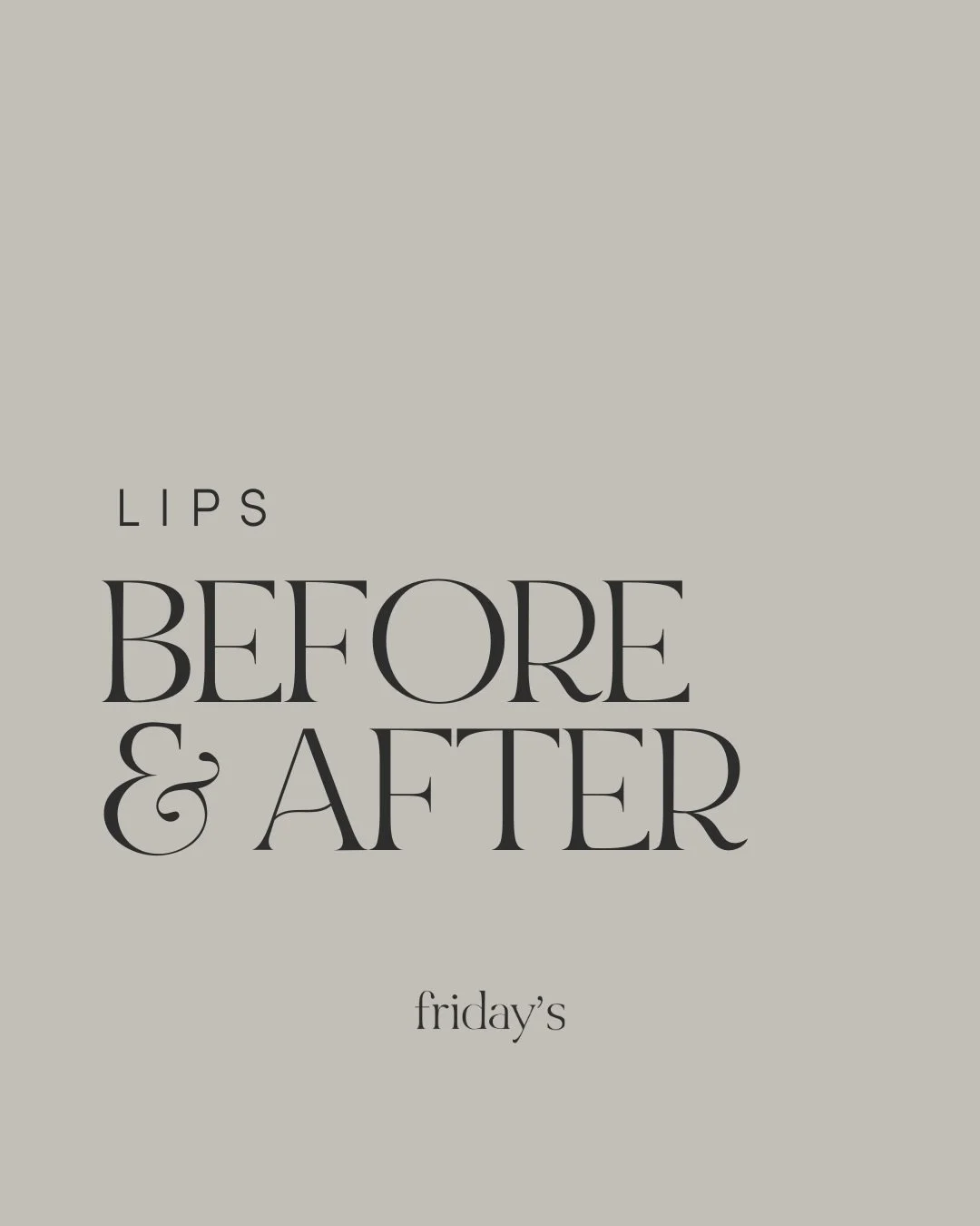 Some people want bigger lips and most people we see just want better lips: softer, smoother, balanced, and just a little juicier 🥰

That&rsquo;s why our approach is always &ldquo;minimal plump, maximum refinement&rdquo;.

Lip filler became controver