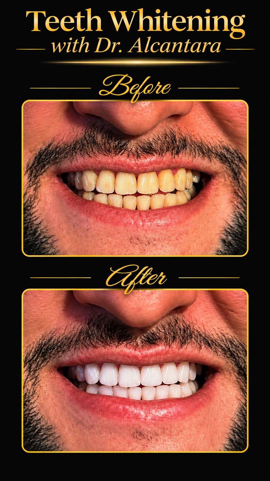 Behind A Whitening