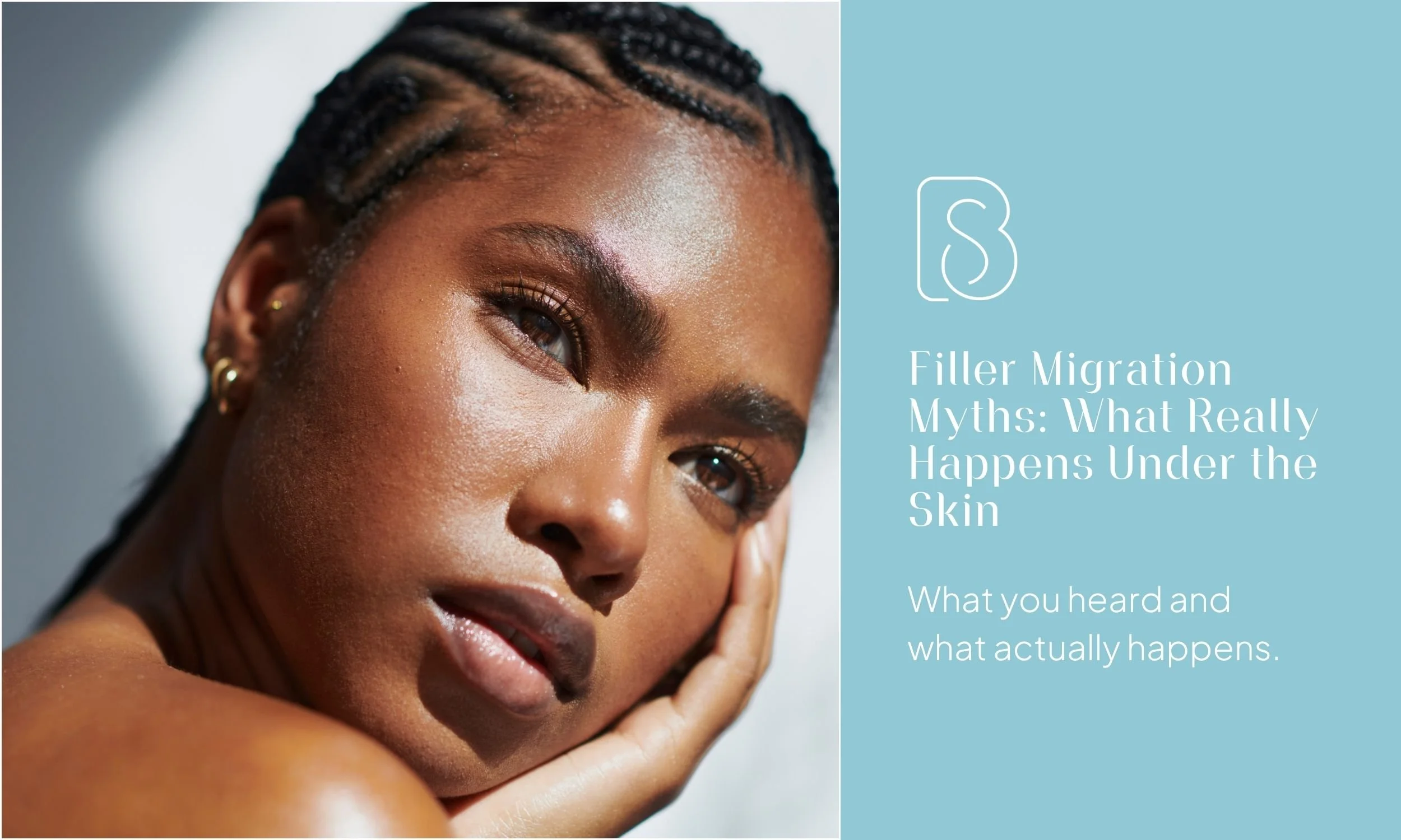 Filler Migration Myths: What Really Happens Under the Skin