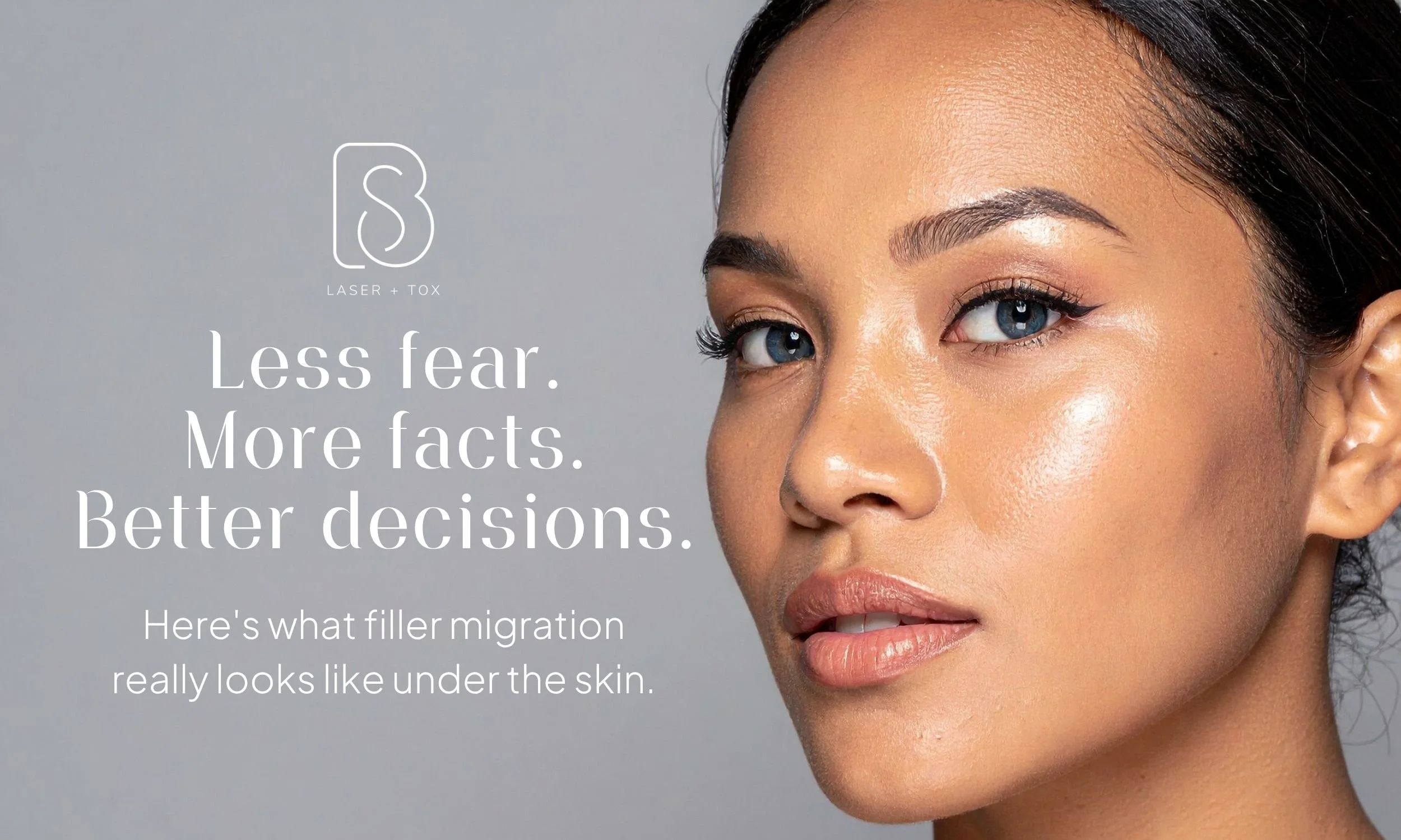 myths and facts about filler migration