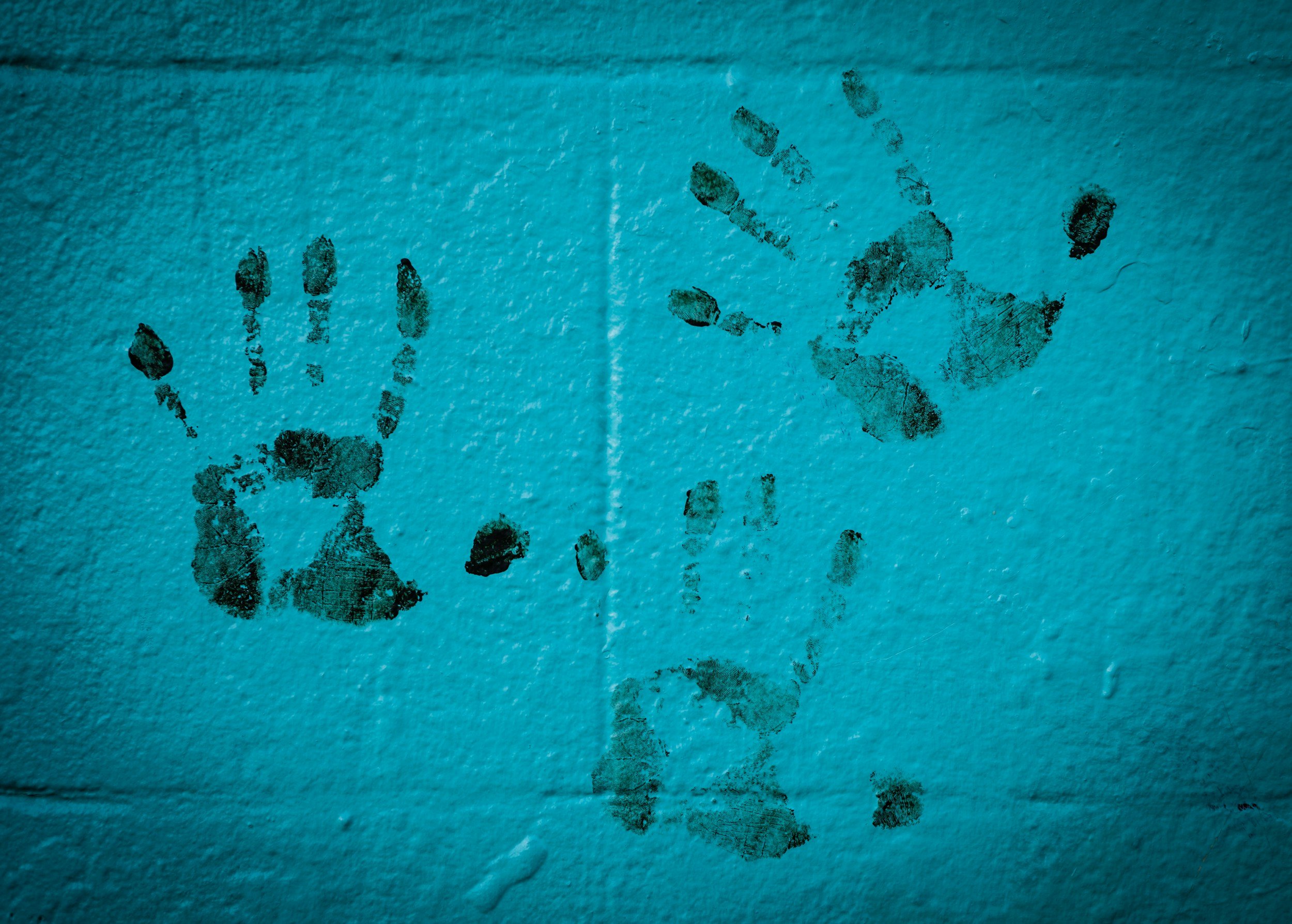 The Limitations of Secondary Transfer DNA Evidence in Louisiana Criminal Cases