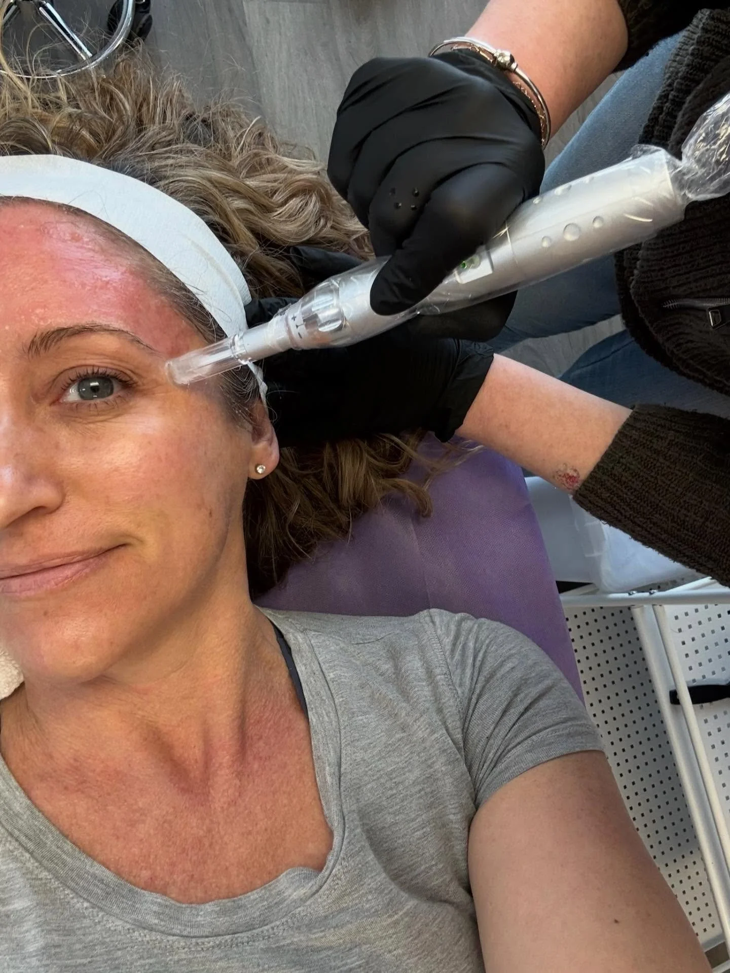 Exciting news ✨

Meghan + Melissa are officially certified in microneedling!

Microneedling is a results-driven treatment that uses tiny, controlled micro-injuries to boost collagen, smooth texture, soften fine lines, and improve overall skin tone, a