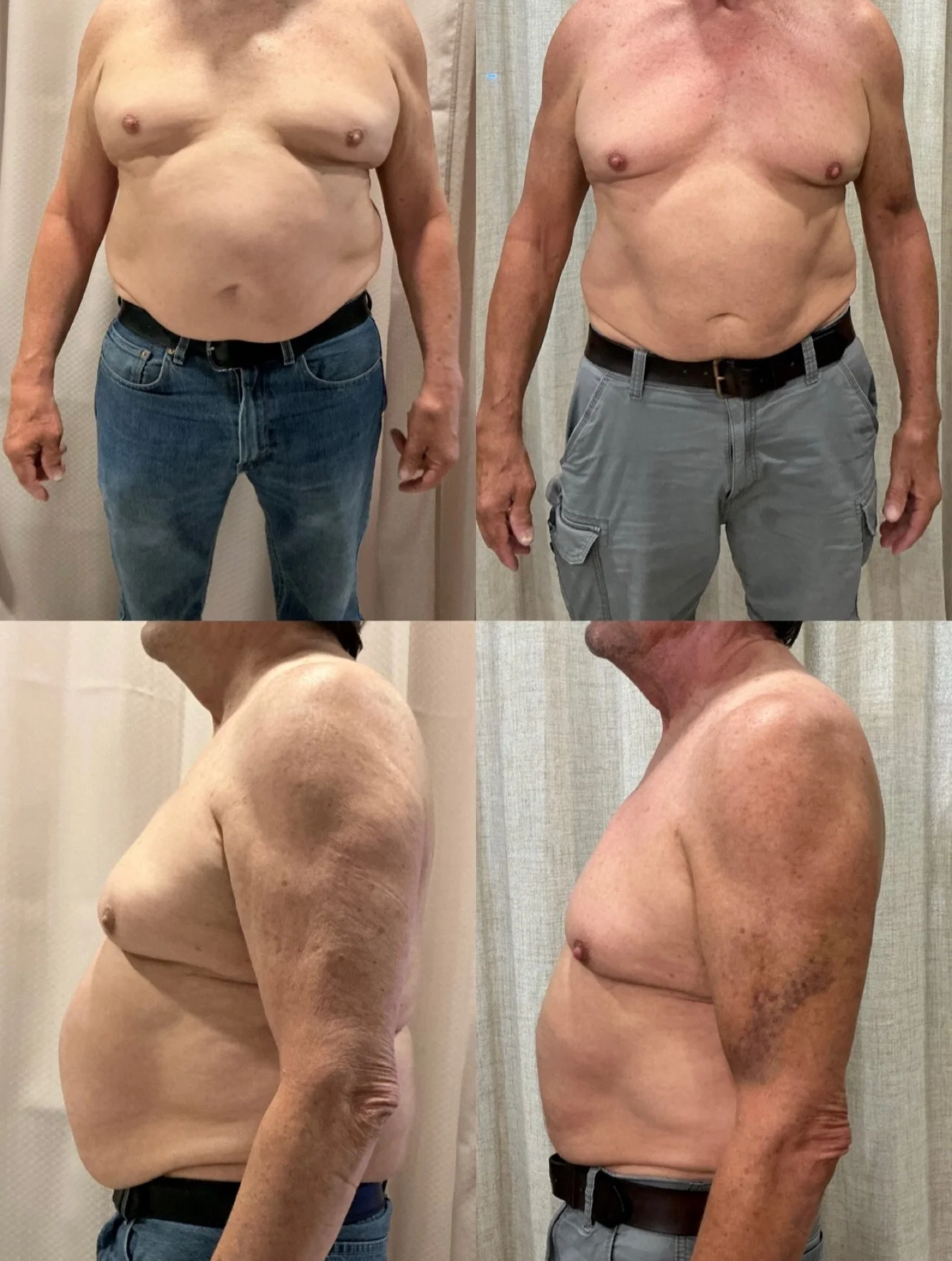 What can five months of personalized care look like?

For this client, it meant a renewed focus on energy, confidence, and overall well-being.

Through individualized, provider-guided therapies, our medical team at River Sirens Collective created a c