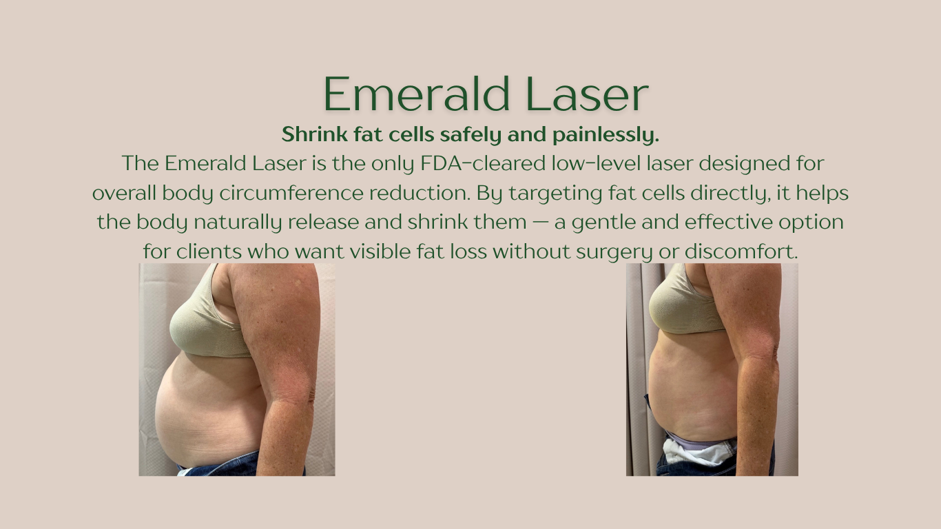 weight loss program washington missouri