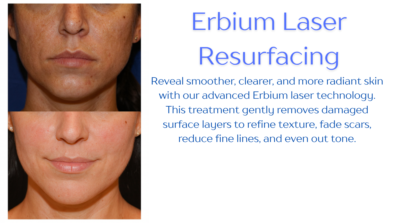 erbium laser facial, skin rejuvenation washington missouri