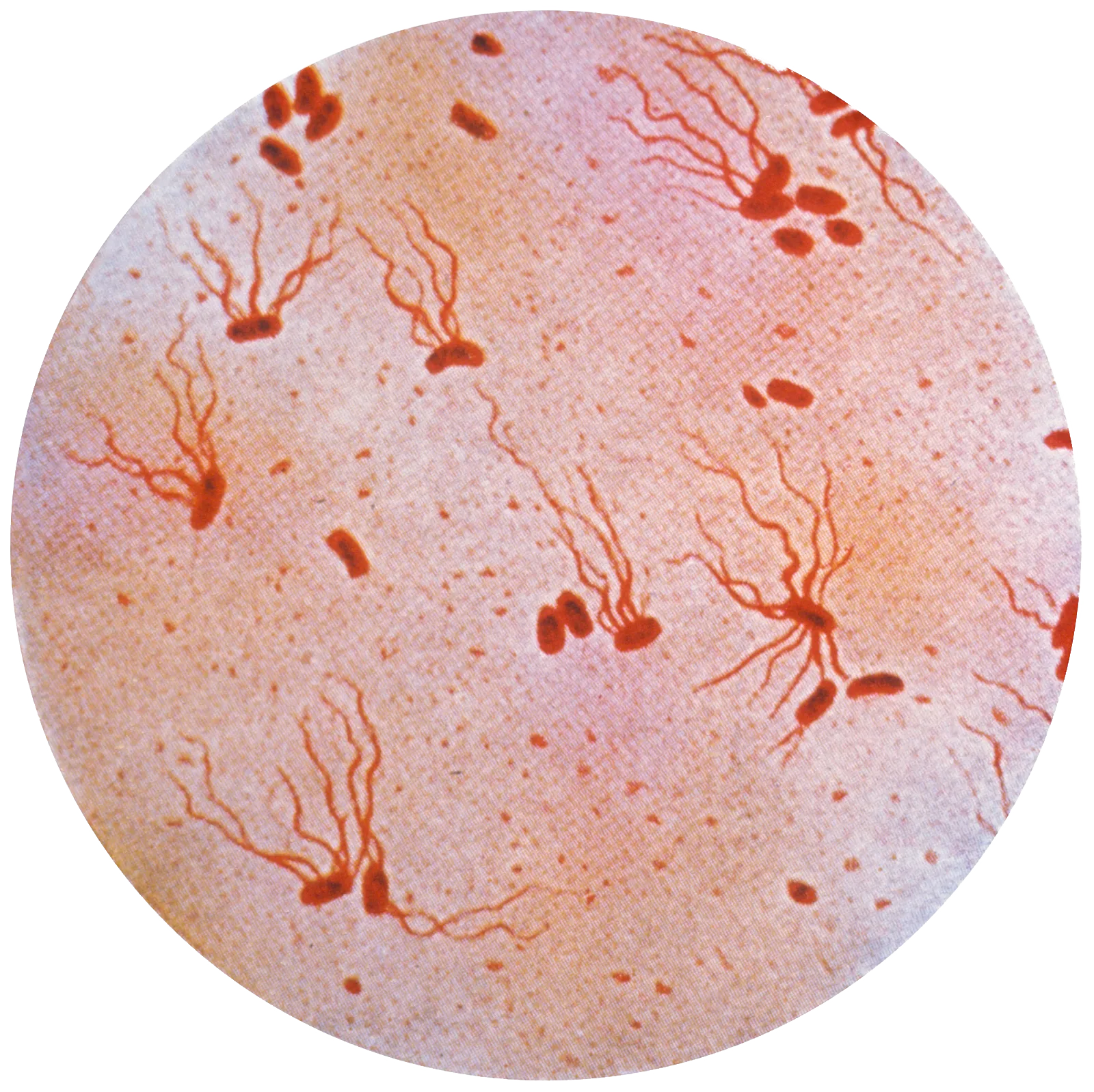 Typhoid Mary Dinner Party