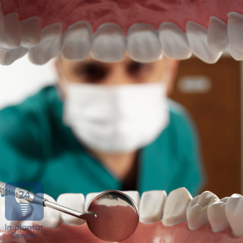 Regelmäßige Kontrollen nach einer Zahnimplantation