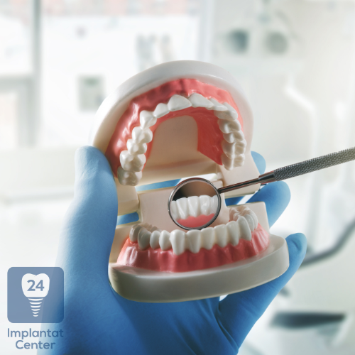 Nachsorge und Pflege nach einer Zahnimplantation