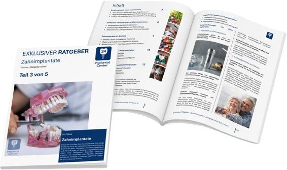 Zahnimplantate 3/5