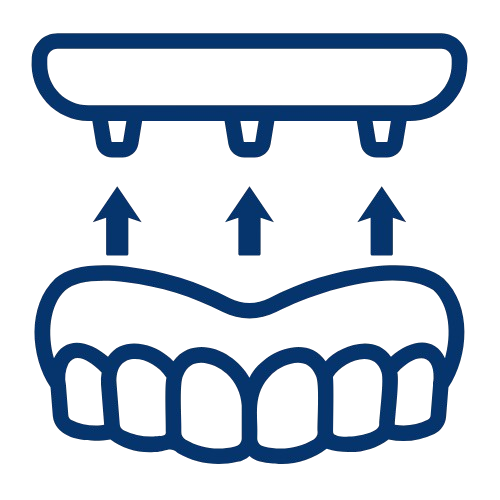 Einführung in die Welt der Zahnimplantate