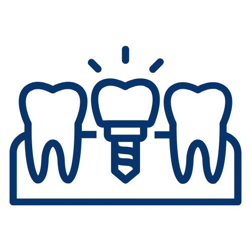 Vorbereitung auf die Zahnimplantation 